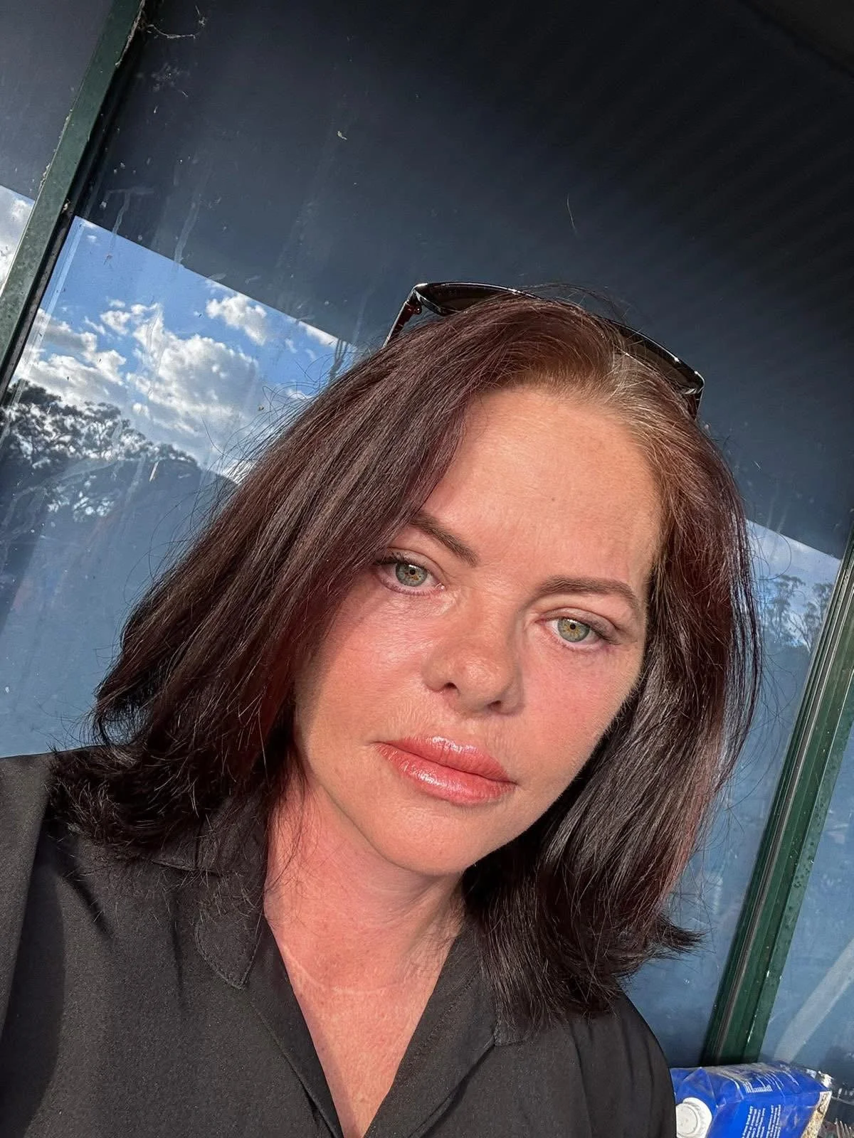 Debbie's Transformative Journey: Full Facelift and Neck Lift