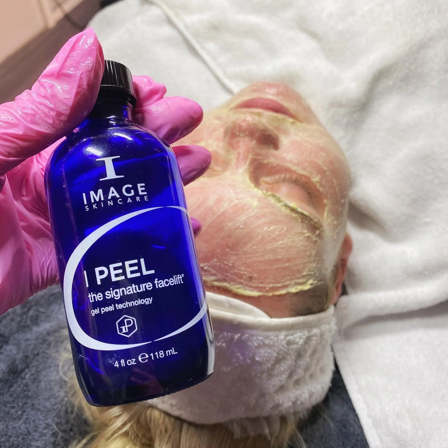 Image Skincare I Peels