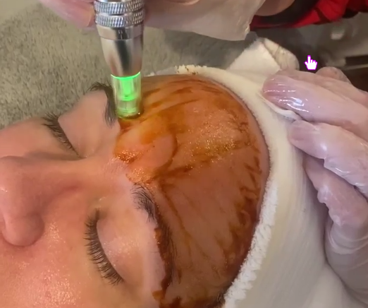 Infusion Facial Payment