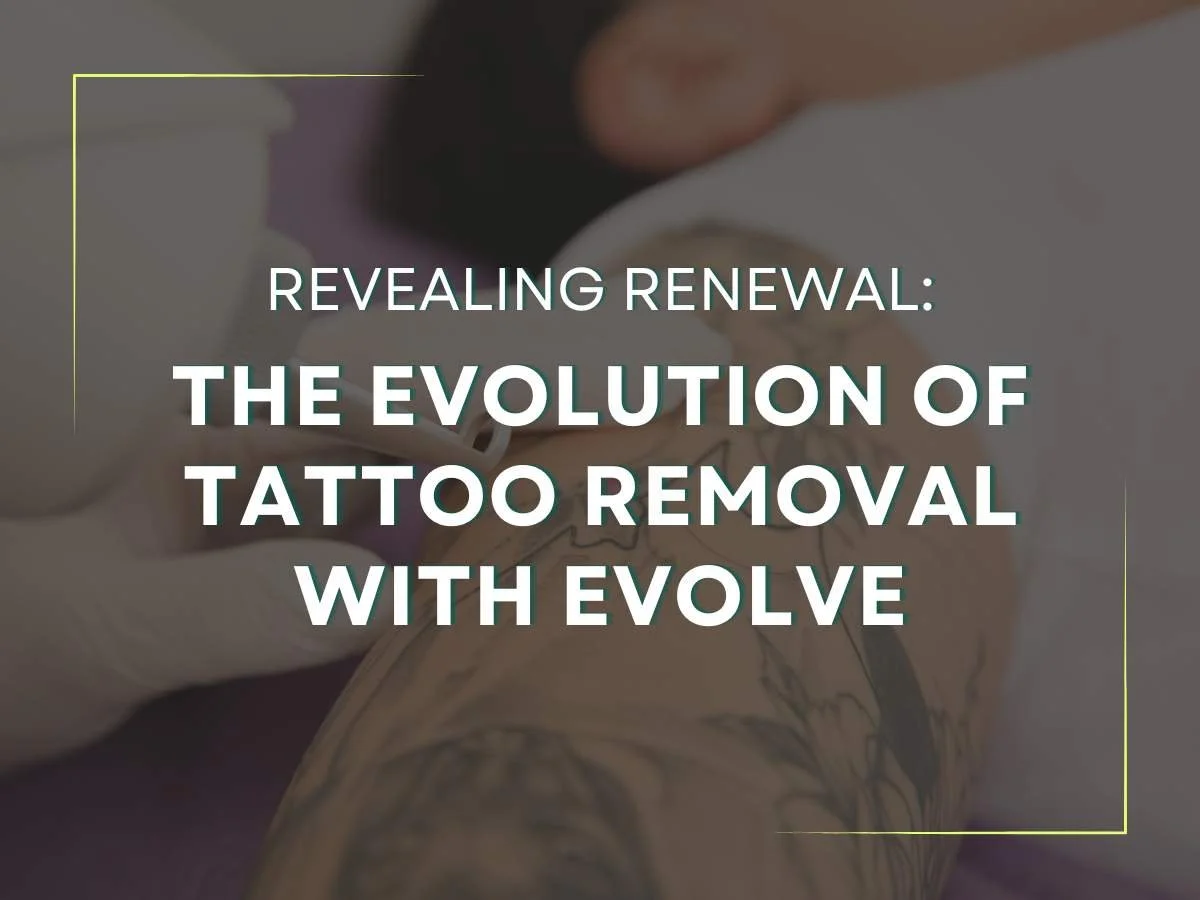 Tattoo Removal Before and After