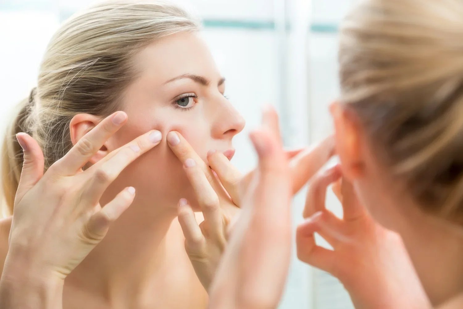 Acne Awareness