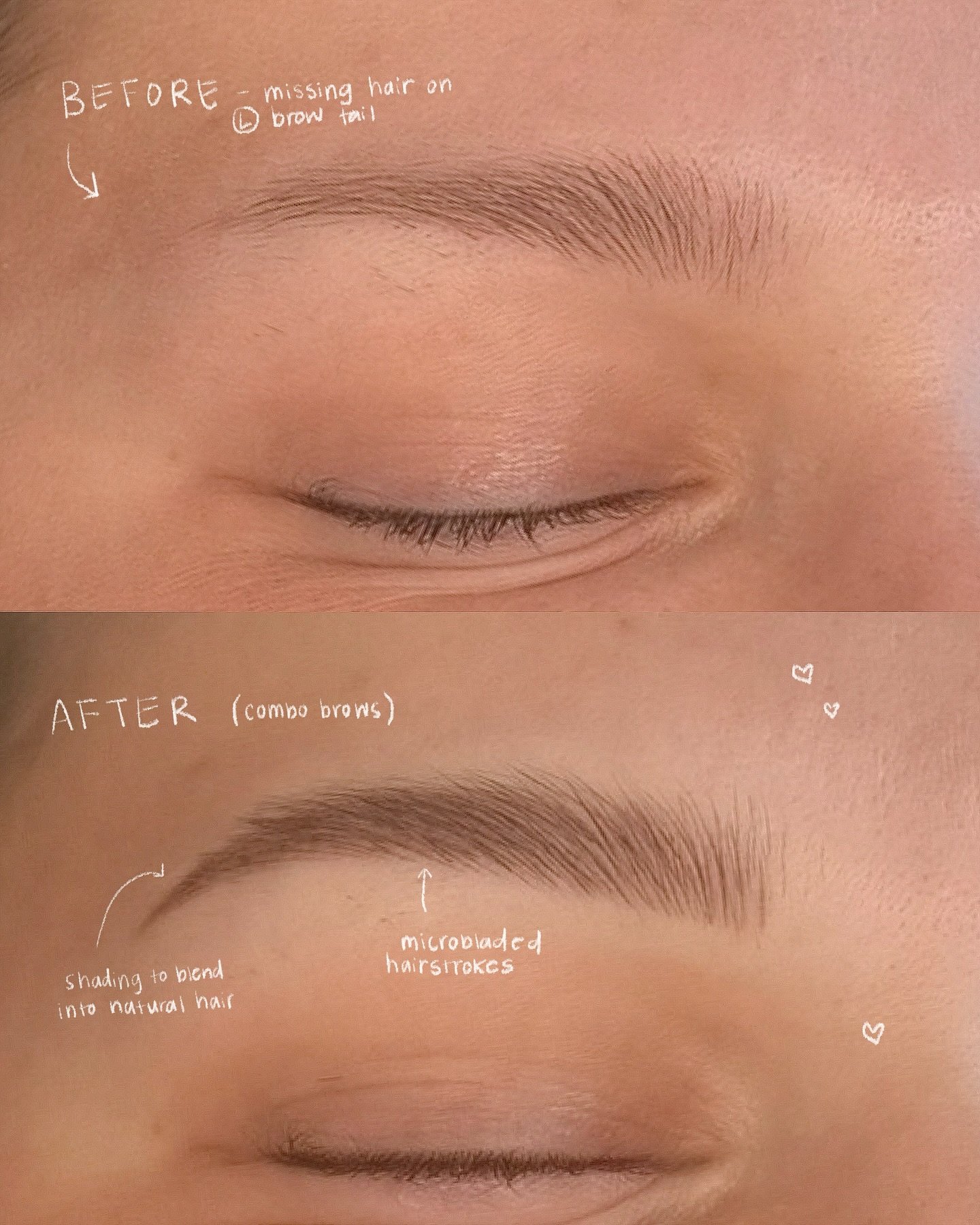 The power of BROWS
wild how something so small can shape your entire face ♡ soft, structured but still you.

Your just one appointment away from never filling them in again 😉

Swipe to see her full combo brow transformation&mdash;&gt;