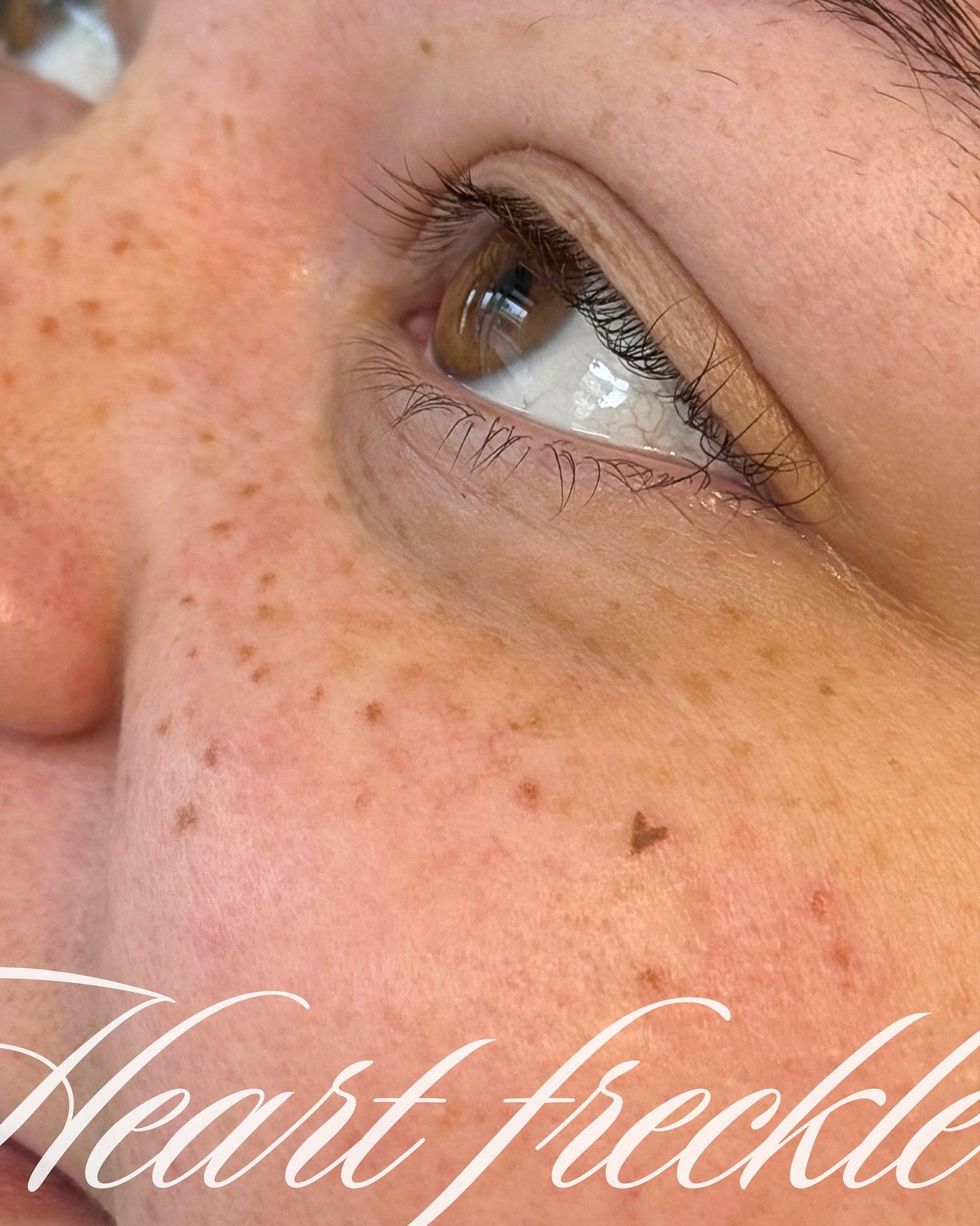 The cutest little heart freckle blended into medium-coverage freckles for her first session 🤎🤎

I&rsquo;m so obsessed with how these turned out. I&rsquo;ve been doing so many freckles lately, and I love how much everyone&rsquo;s been loving them to