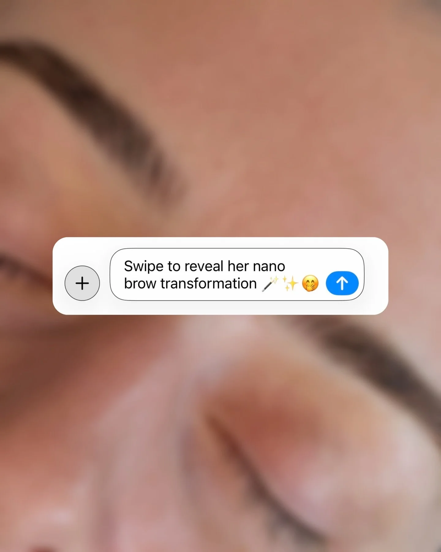 𝙽𝙰𝙽𝙾 𝚊𝚔𝚊 𝚖𝚊𝚌𝚑𝚒𝚗𝚎 𝚑𝚊𝚒𝚛𝚜𝚝𝚛𝚘𝚔𝚎𝚜 ✒️✨

My lovely model has sensitive skin that bleeds/turns red easily, which makes it even more impressive how gentle the nano technique is. These photos were taken immediately after and her rednes