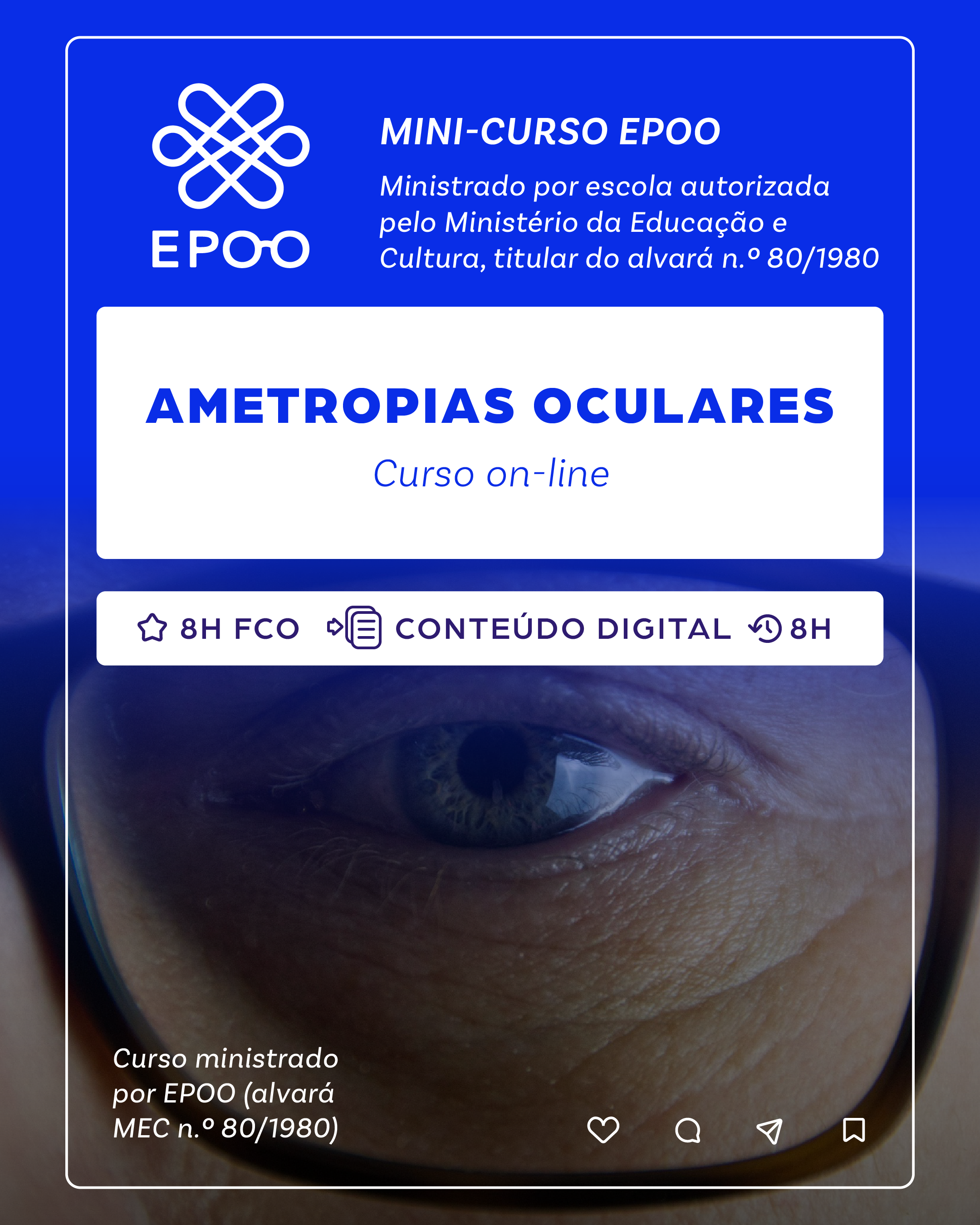 Ametropias Oculares - 2ª Edição