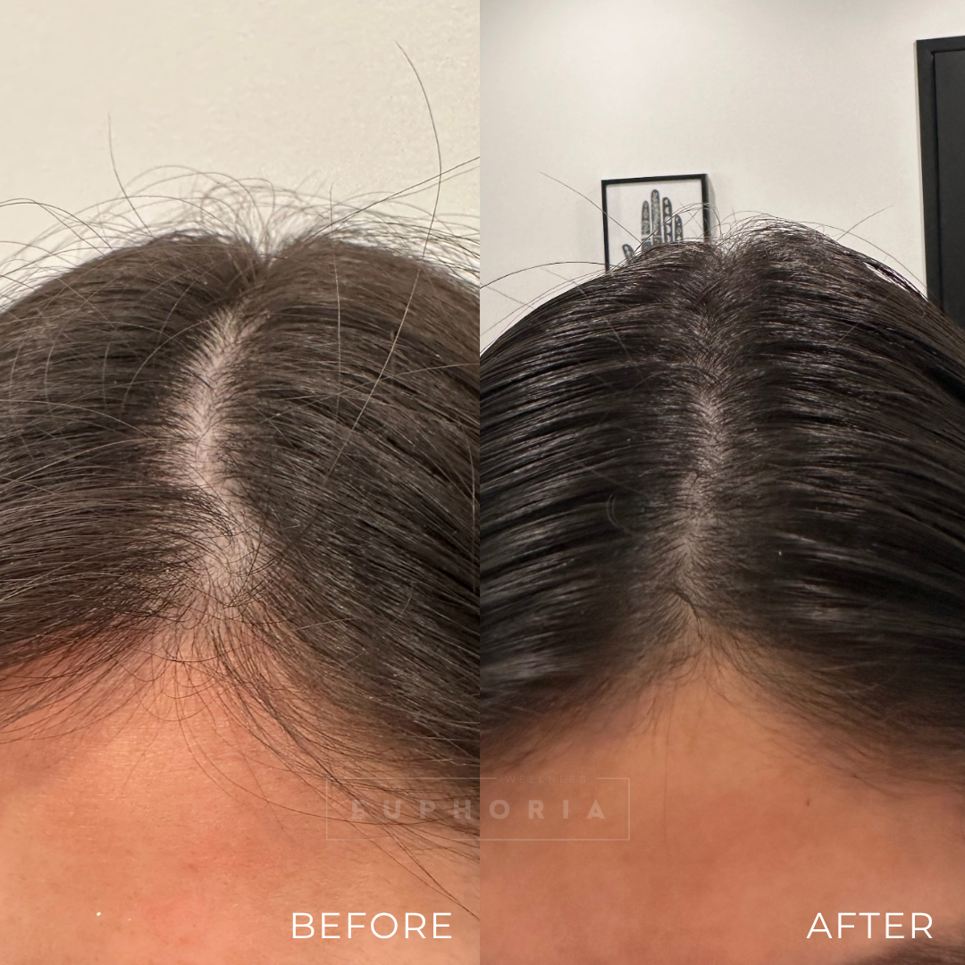 6 MONTH BEFORE AND AFTER