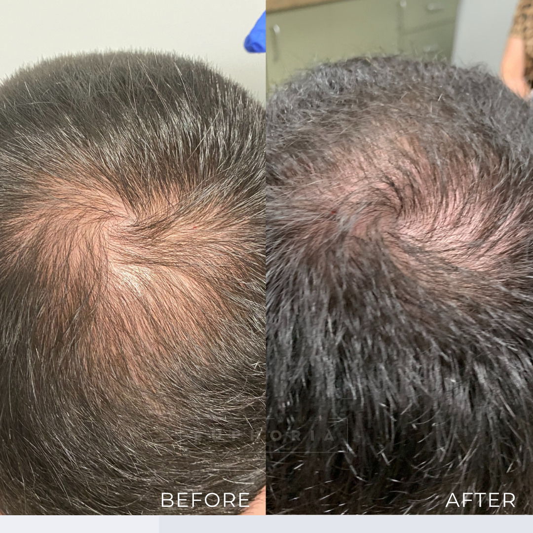 3 MONTH BEFORE AND AFTER