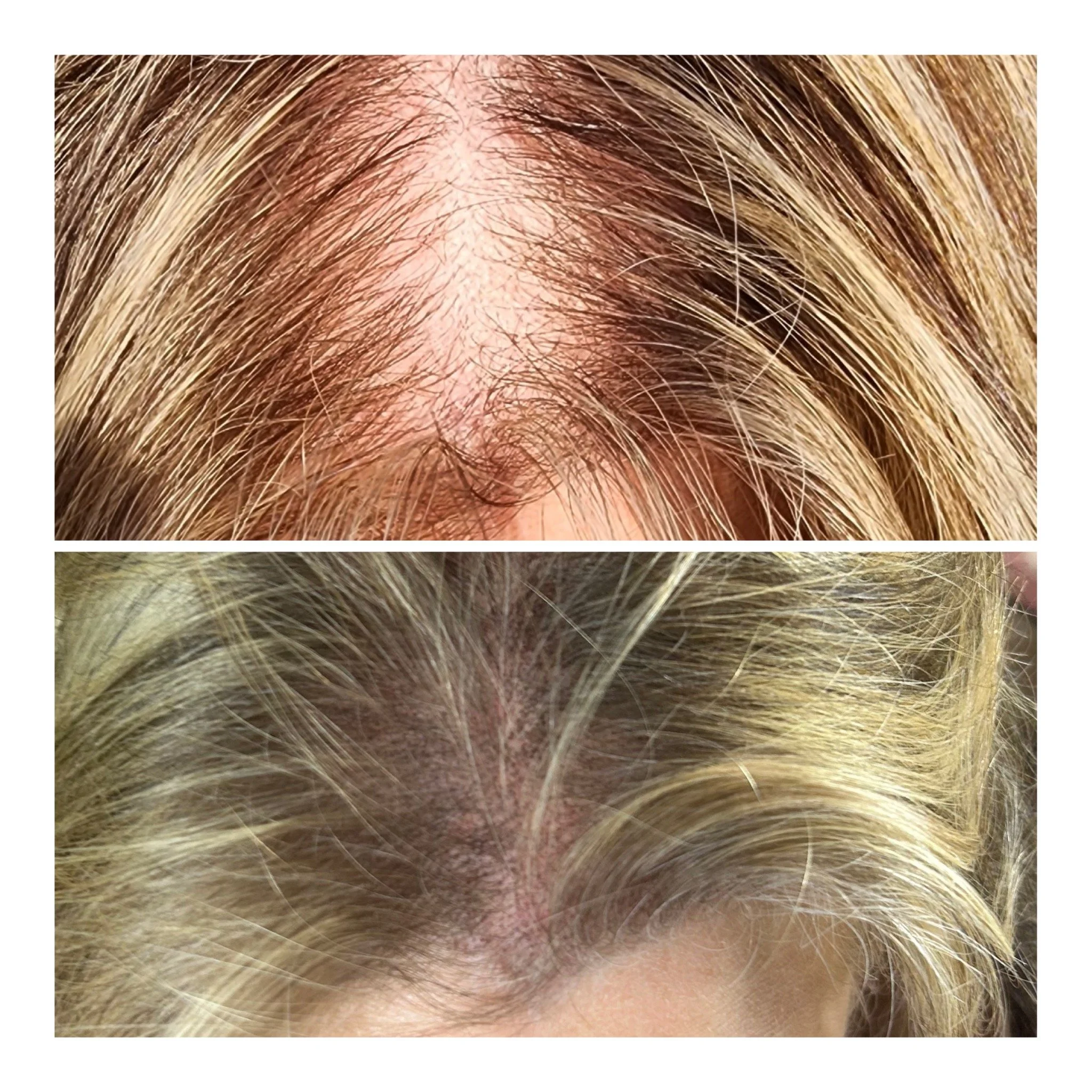 Before & After Session #2