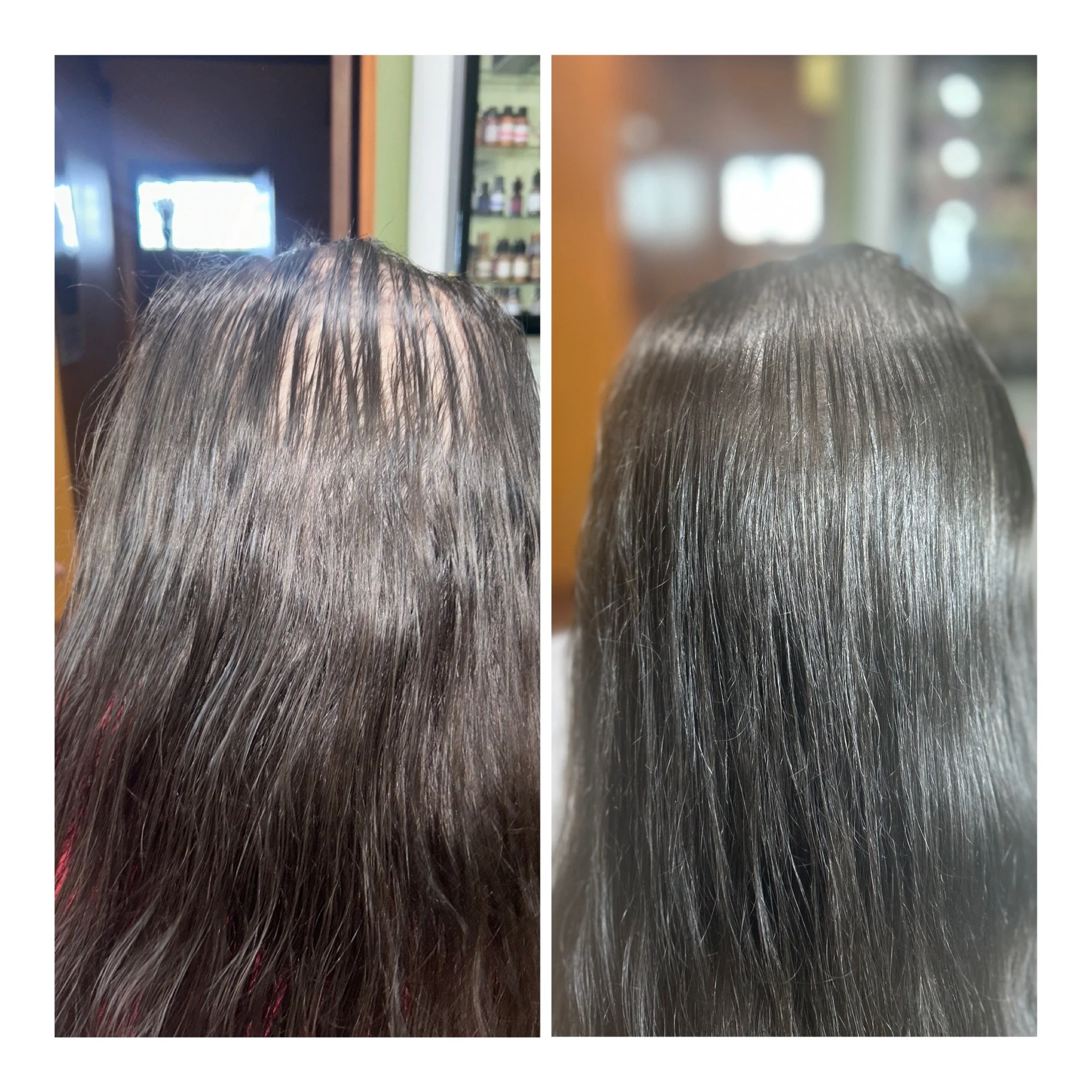 Before & After (4 Sessions Total) 