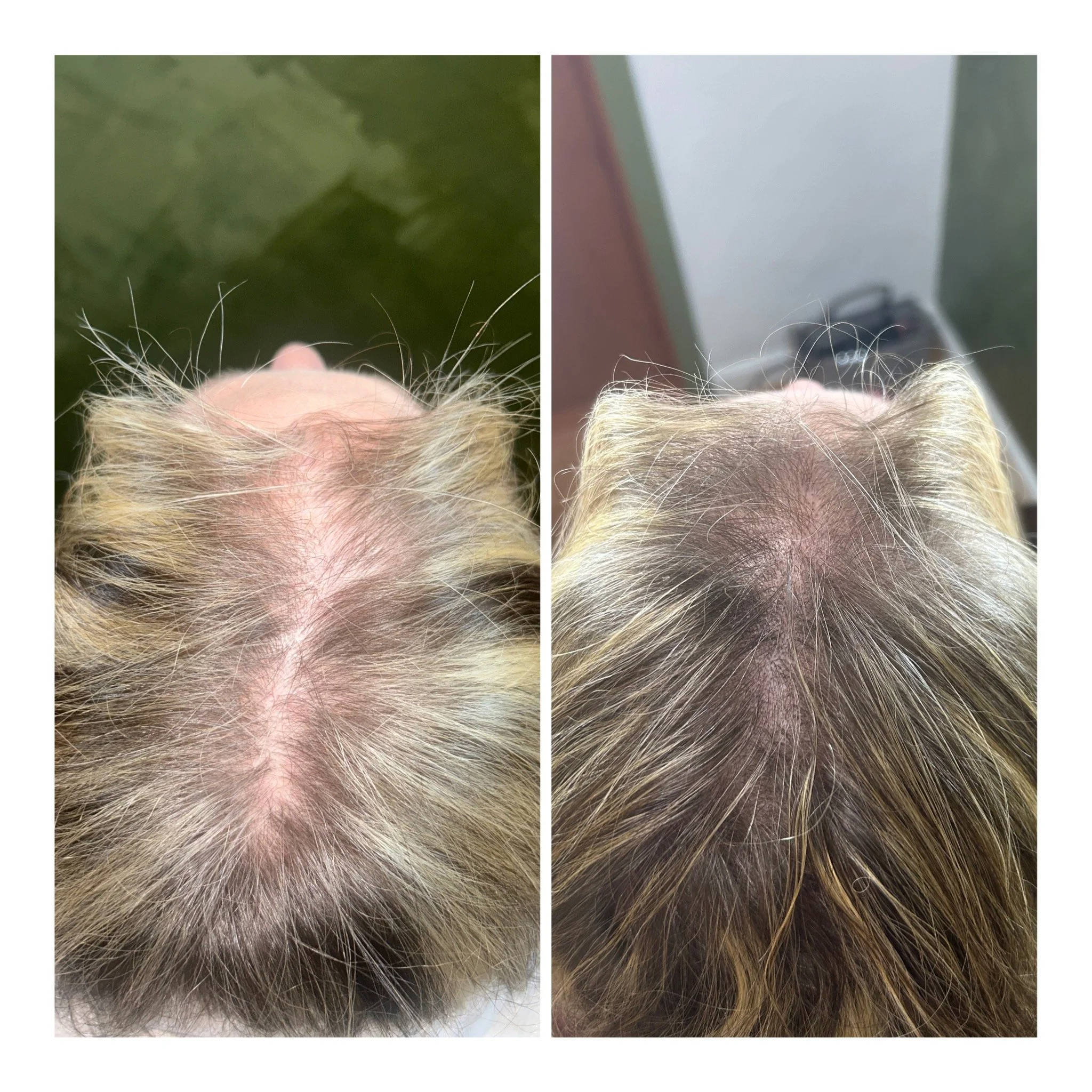 Before & After Session #2