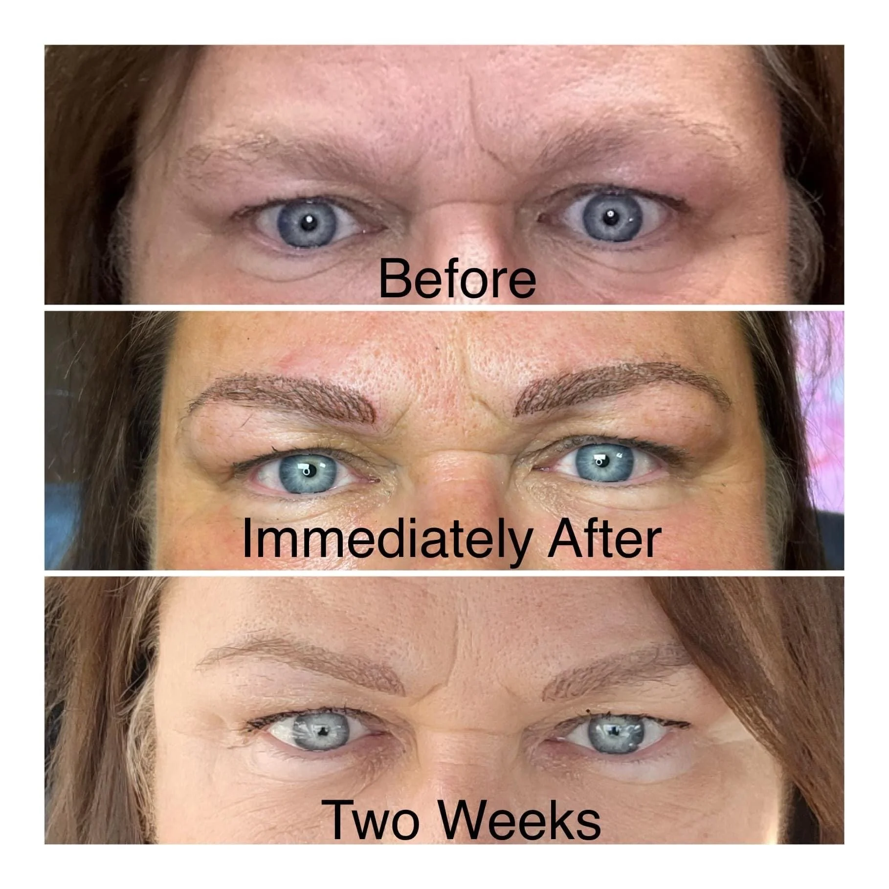 Eyebrows Before / Immediately After/ Two Weeks healed