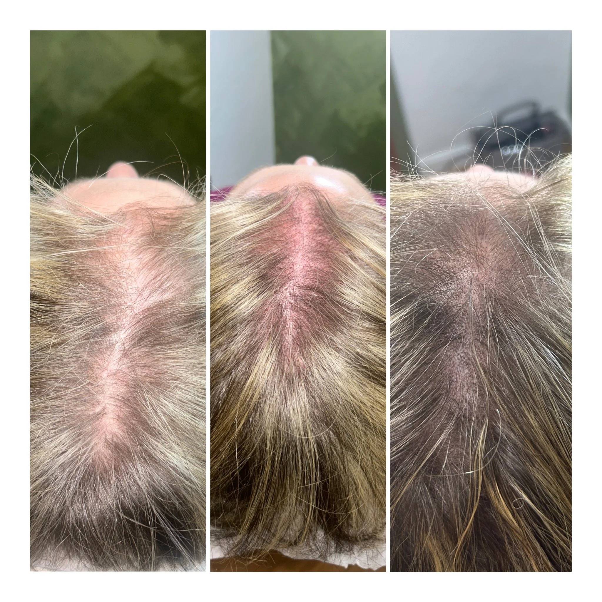 Before / Session #1 / Session #2 