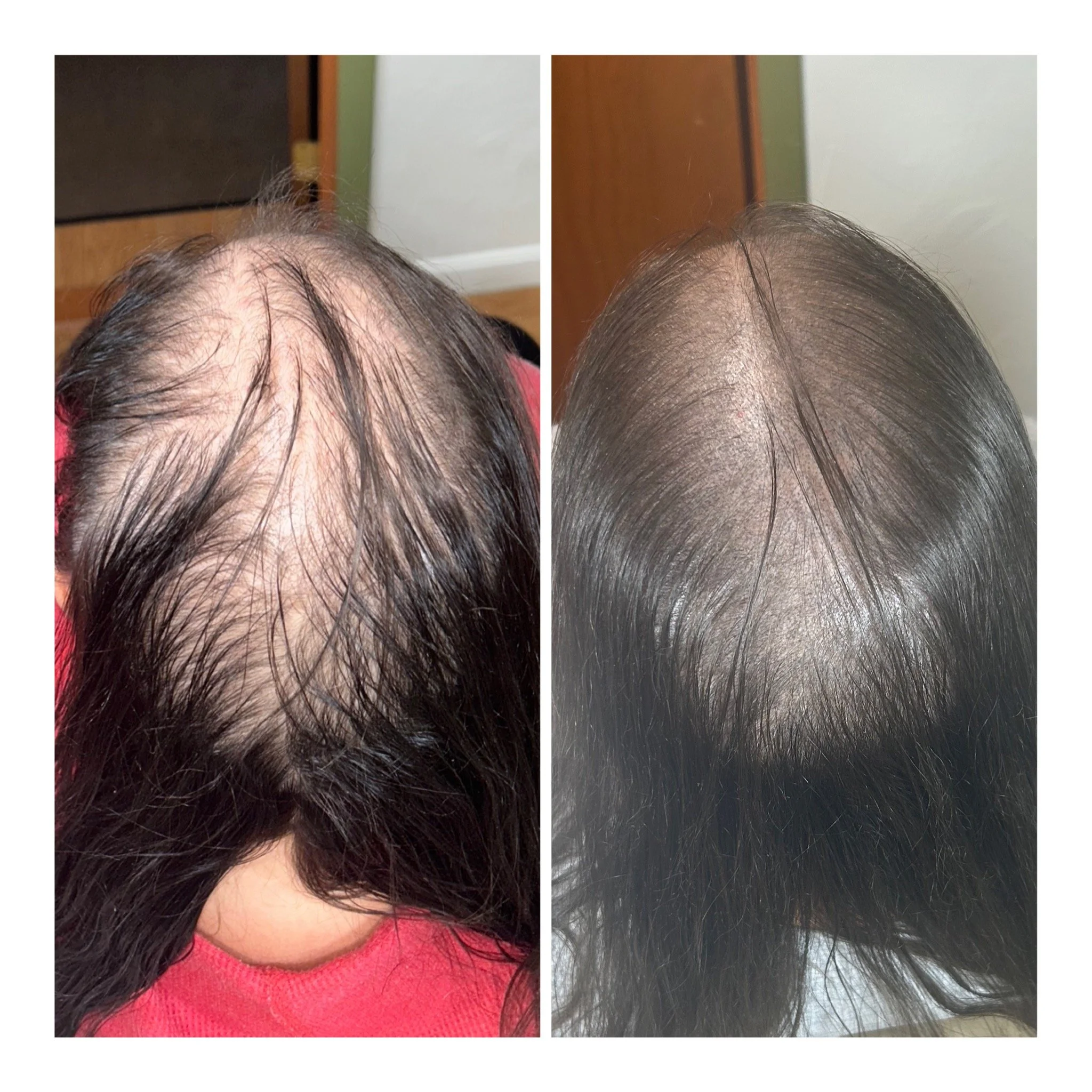 Before & After SMP 4 Sessions