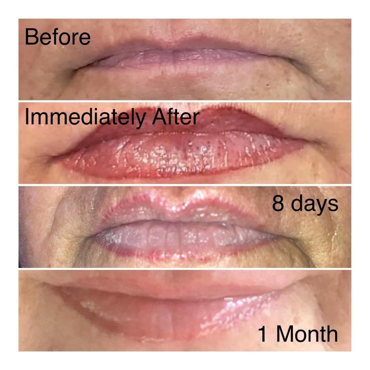 Lip Tattoo Process from Before to 1 month after