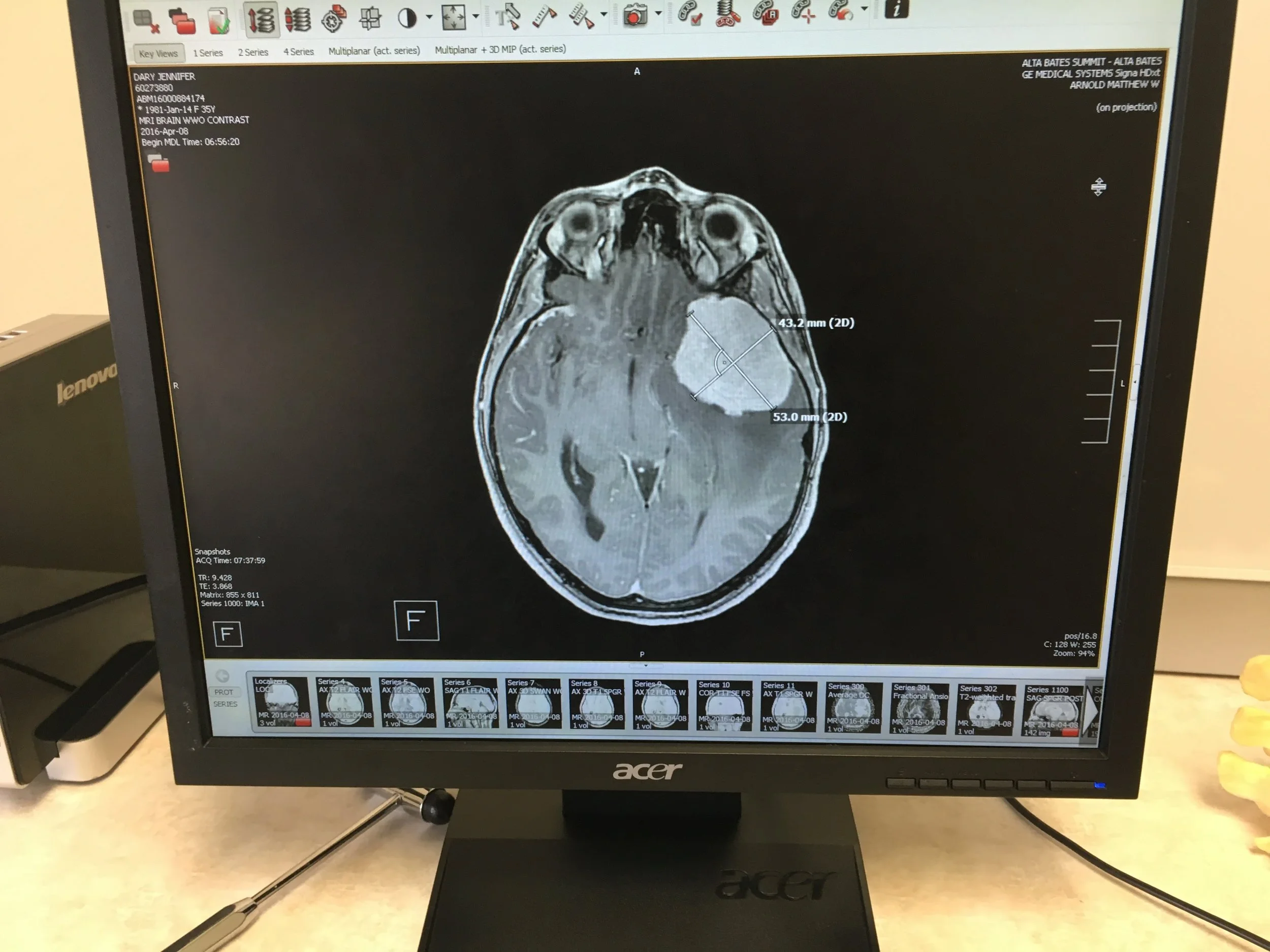 The original MRI, April 2016