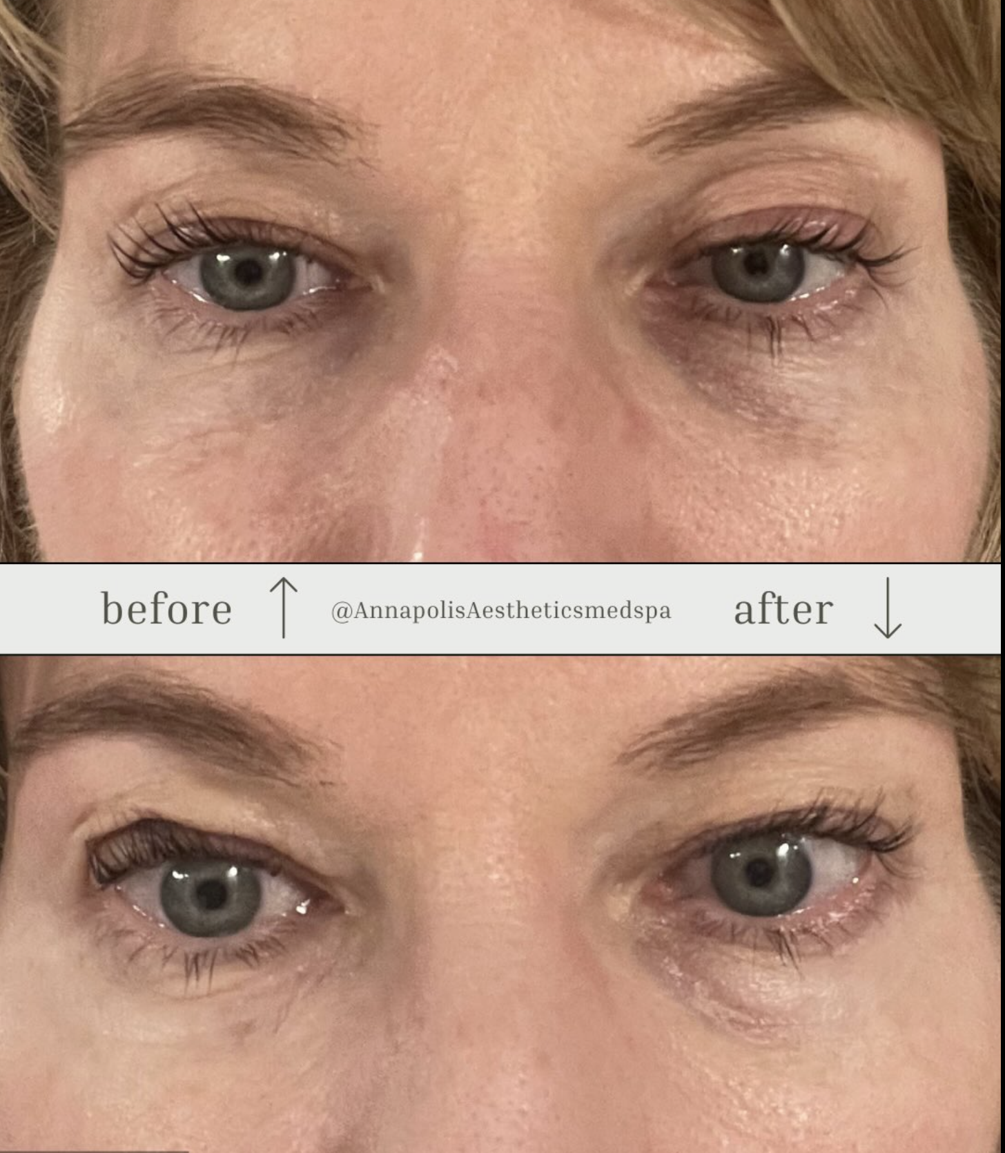 New Products From PCA Skin