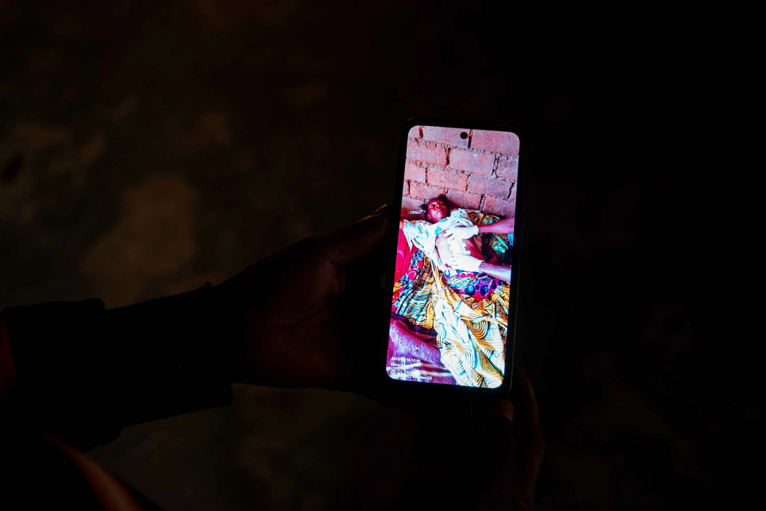 Increasing number of surgical operations reported after the installation of Tenke Fungurume Mining’s smelter plant. Lualaba Province, Democratic Republic of the Congo,.