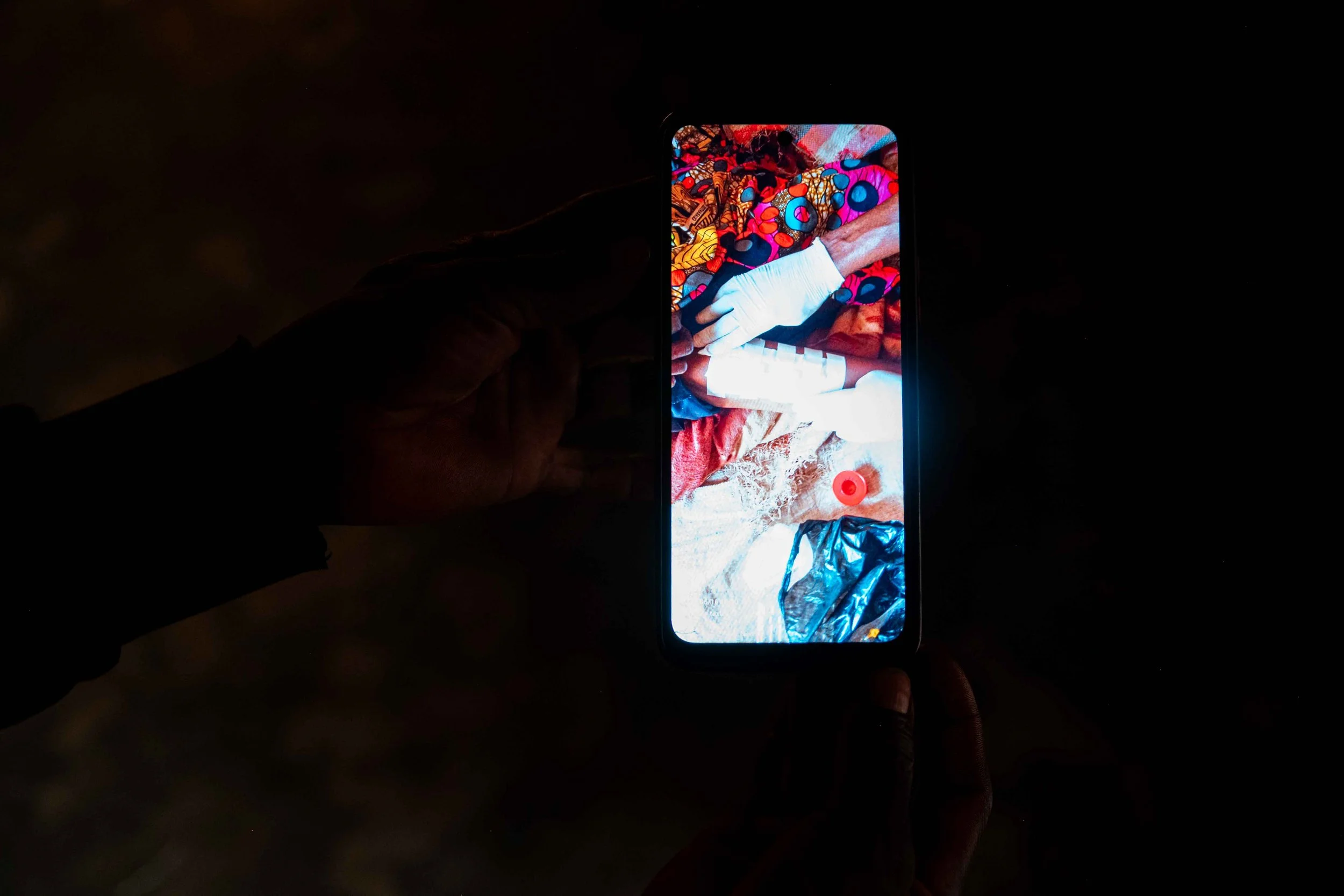 Increasing number of surgical operations reported after the installation of Tenke Fungurume Mining’s smelter plant. Lualaba Province, Democratic Republic of the Congo,.