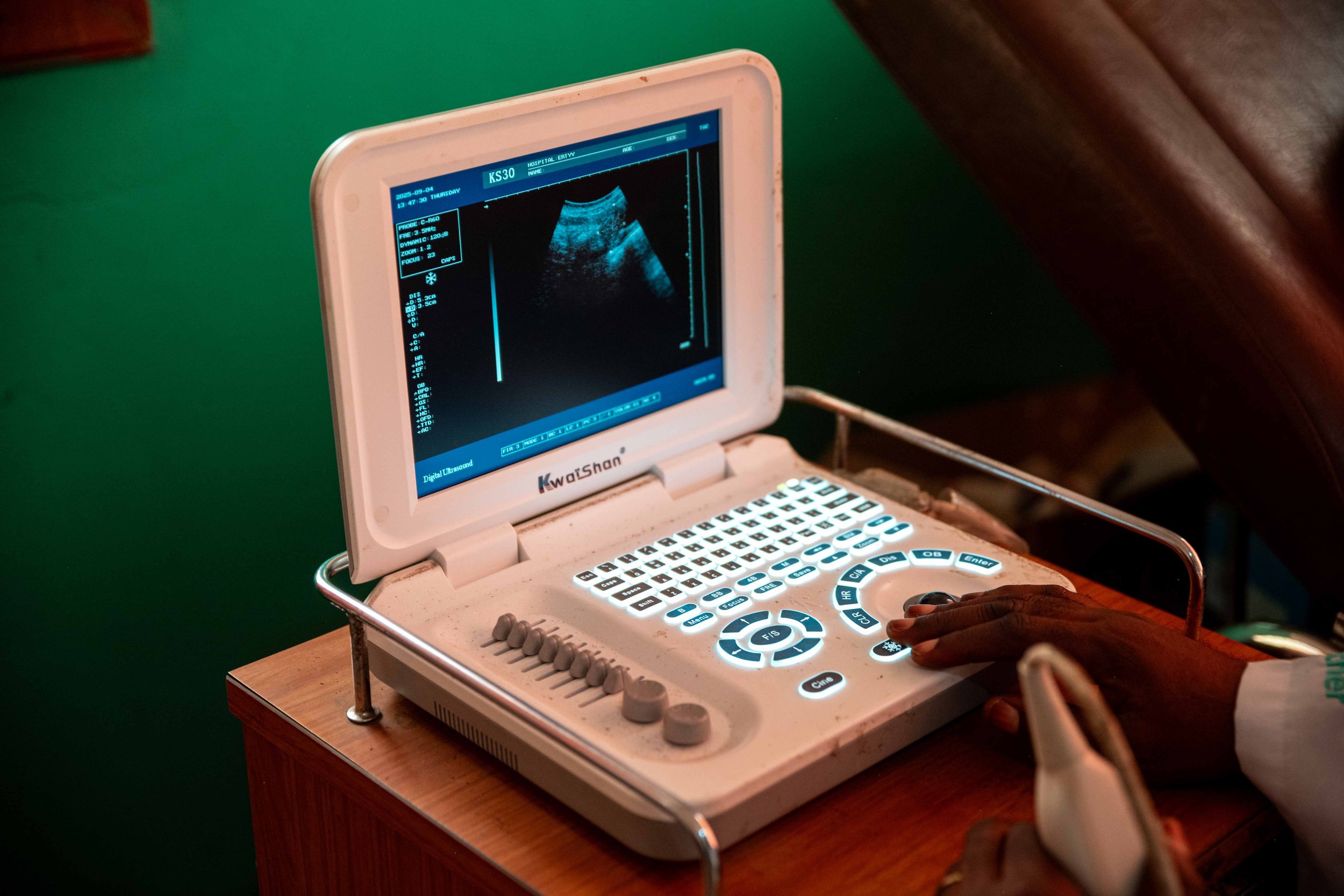 Ultrasound machine at the Paganoani Center in Kwilu, Democratic Republic of Congo, September 2025.