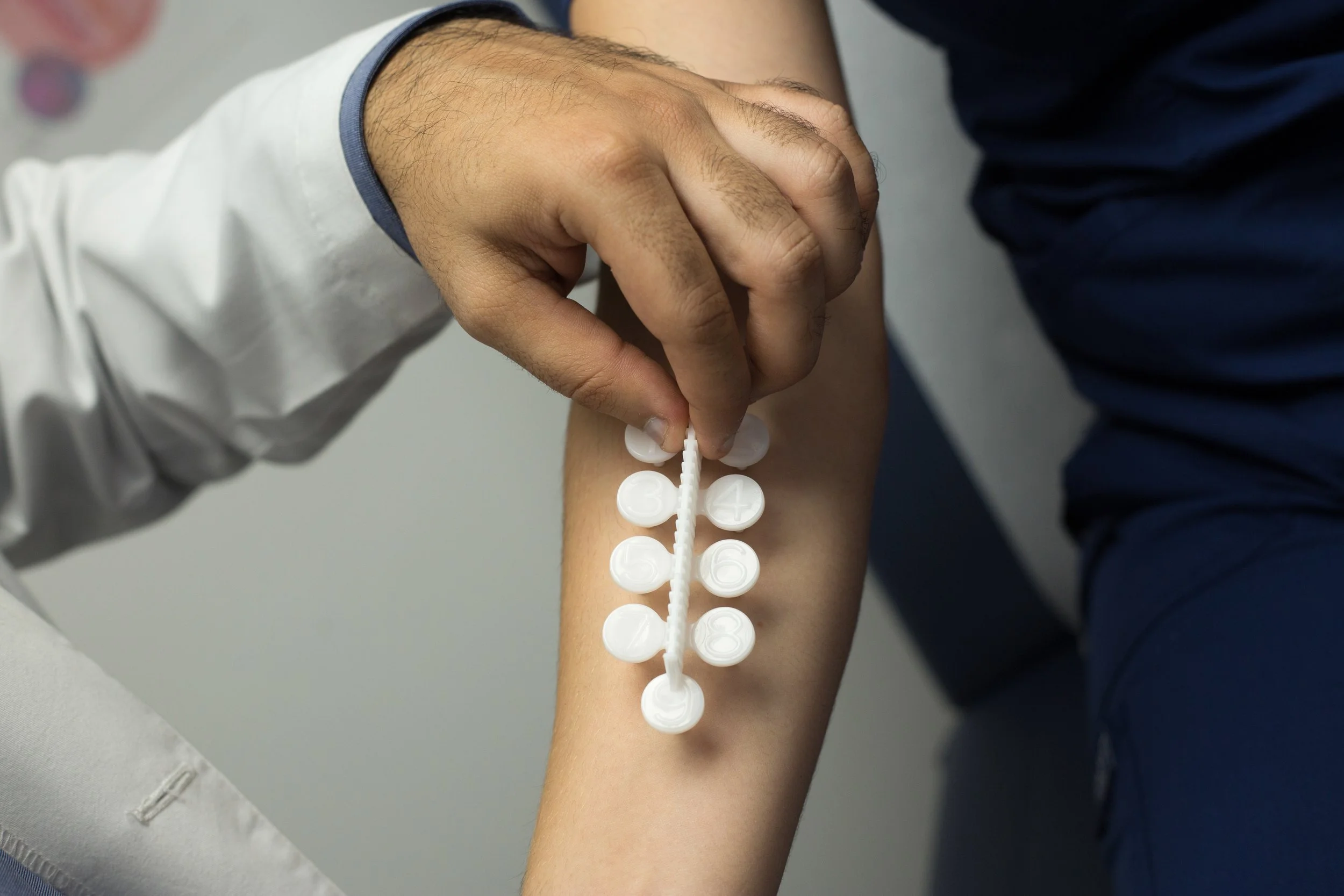 AdobeStock_230477775 - Skin prick testing.jpeg