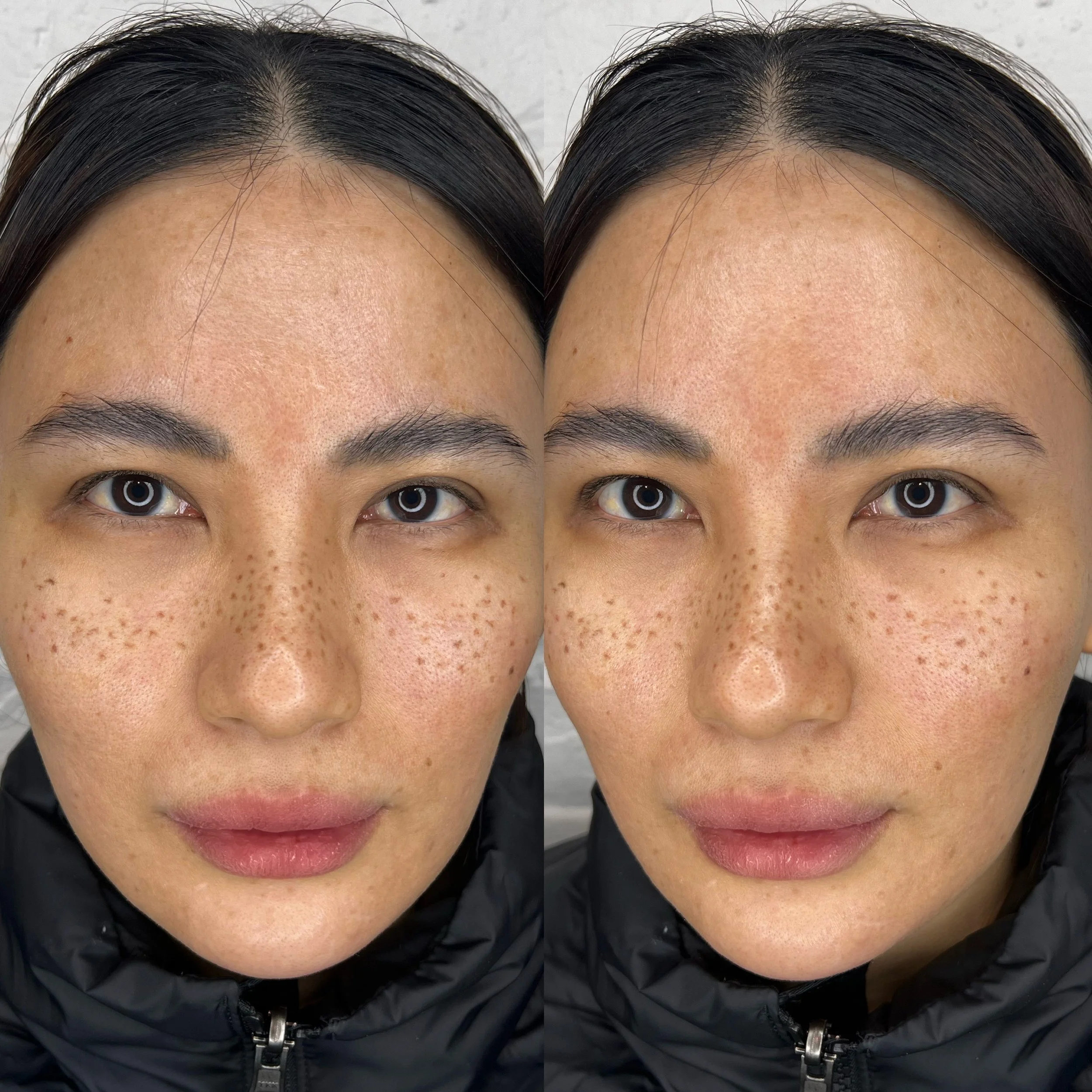 Facetune_15-01-2025-08-37-31.jpg