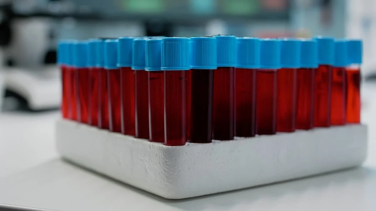Rack of blood sample tubes with blue caps in a laboratory, representing testosterone lab testing.