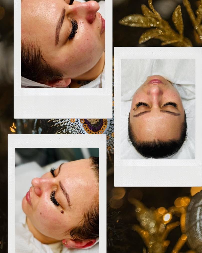 Long-term relationships lead to real results !!!
That is trust, consistency, and personalised care 🤍
With clients permission, I&rsquo;m sharing this glow to highlight what tailored treatments + commitment can truly achieve.

Her skin has honestly ne