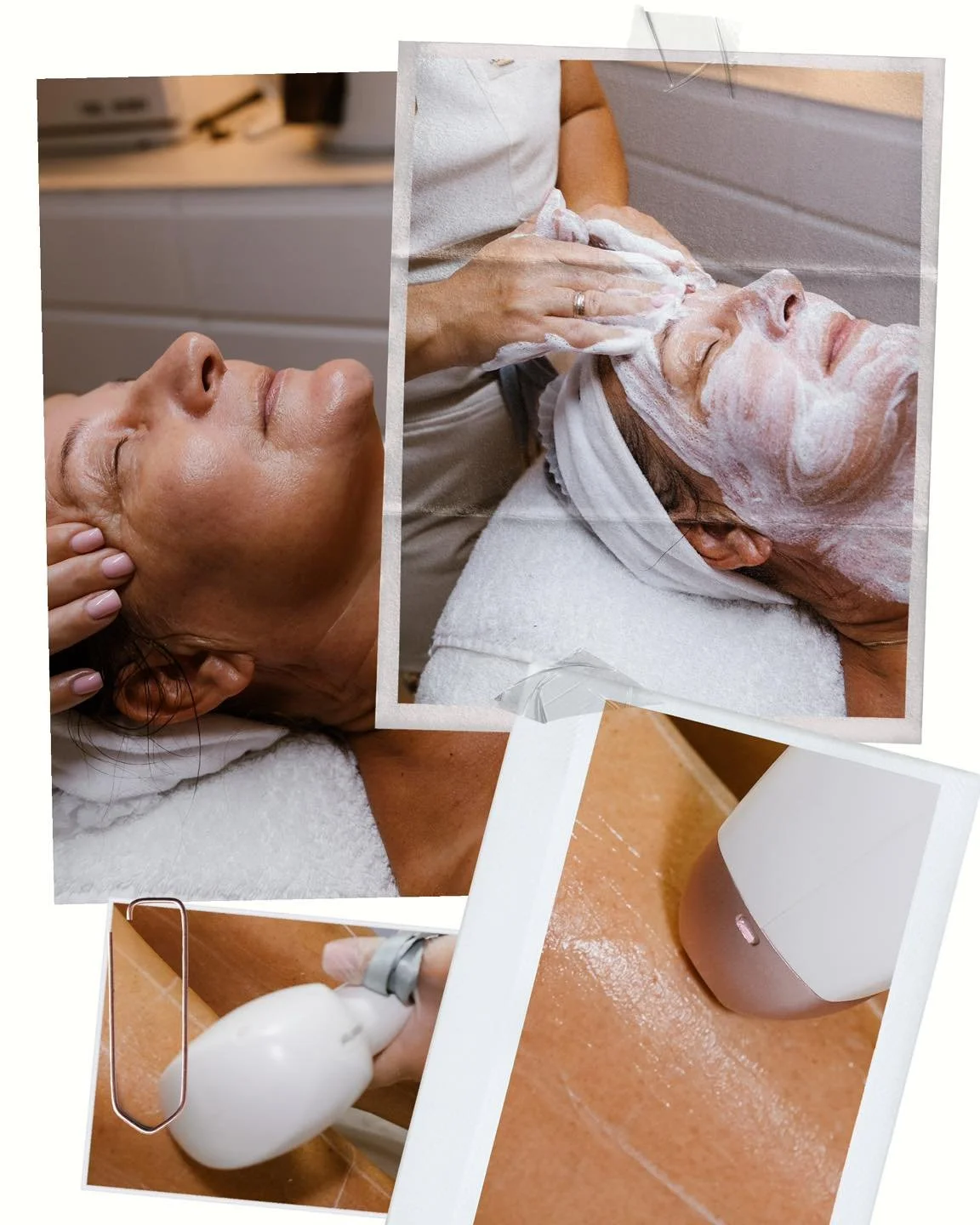 IPL Skin Rejuvenation &ndash; How It Works &amp; Who It&rsquo;s For 

Intense Pulsed Light (IPL) skin rejuvenation is a non-invasive treatment designed to improve overall skin tone and texture by targeting pigmentation, redness, and signs of photoagi