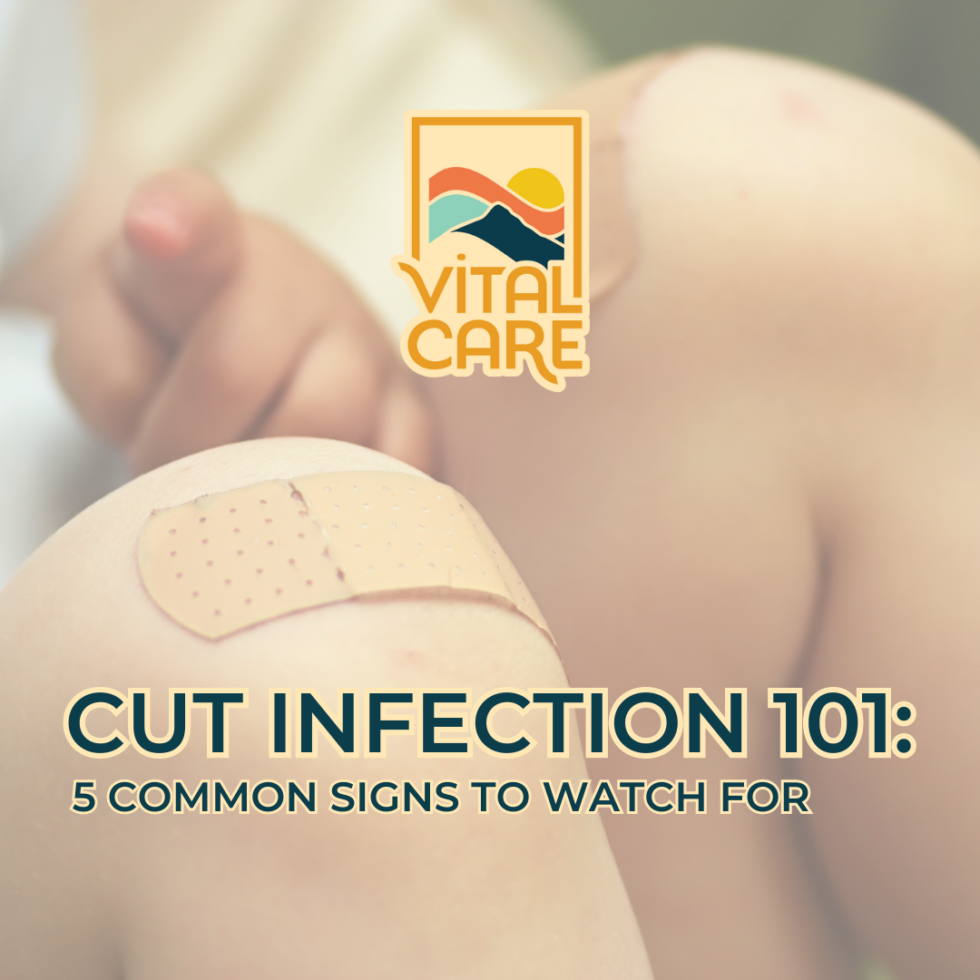 Cut Infection 101: Vital Care Clinic Reveals 5 Common Signs to Watch For