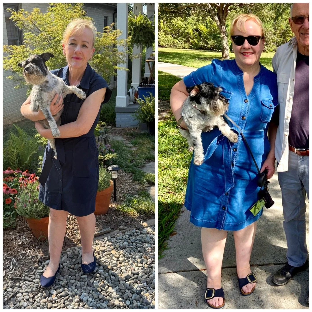 My Lipedema Journey: Finding Answers, Finding Hope