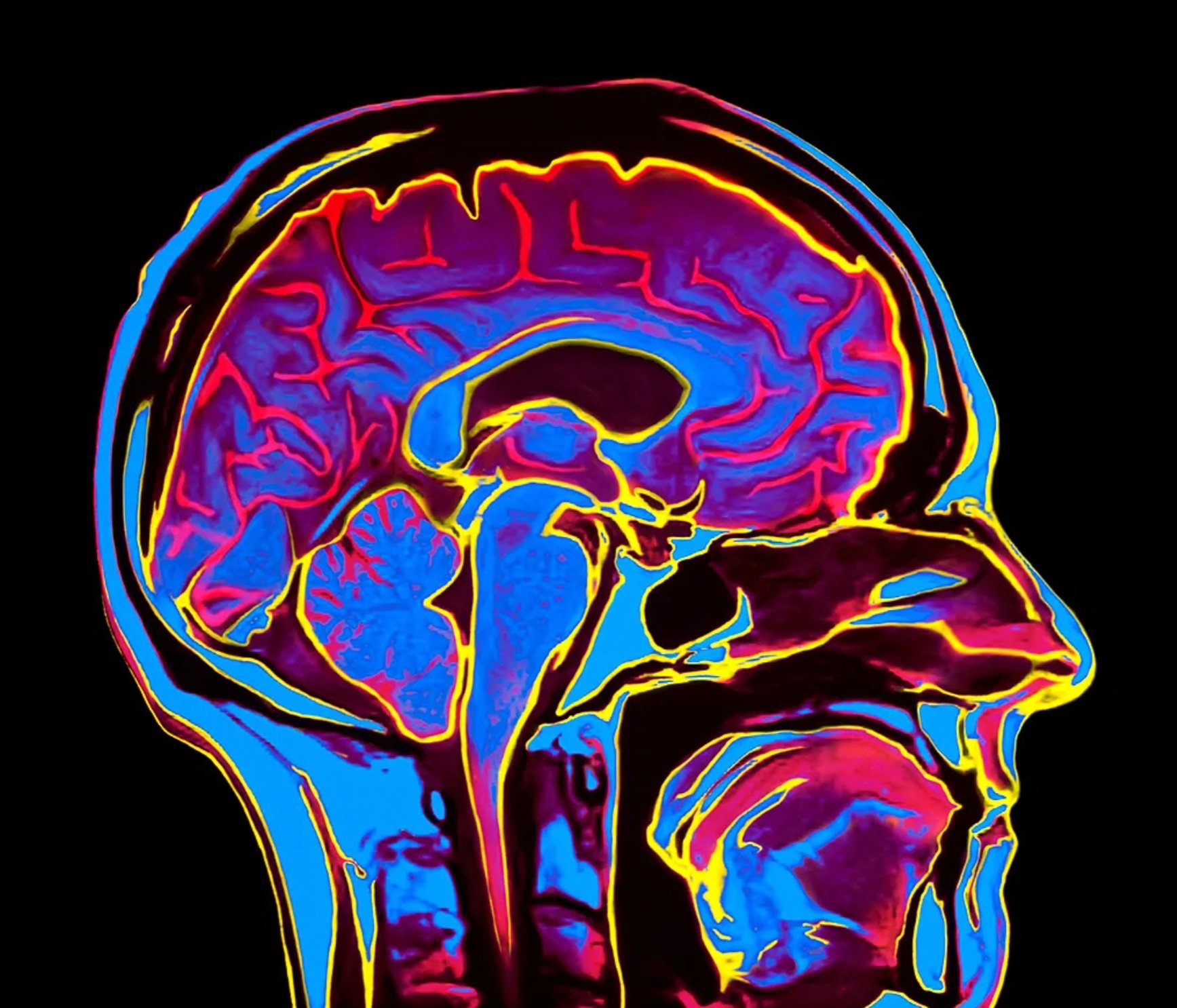 Are Creative People Smarter?
