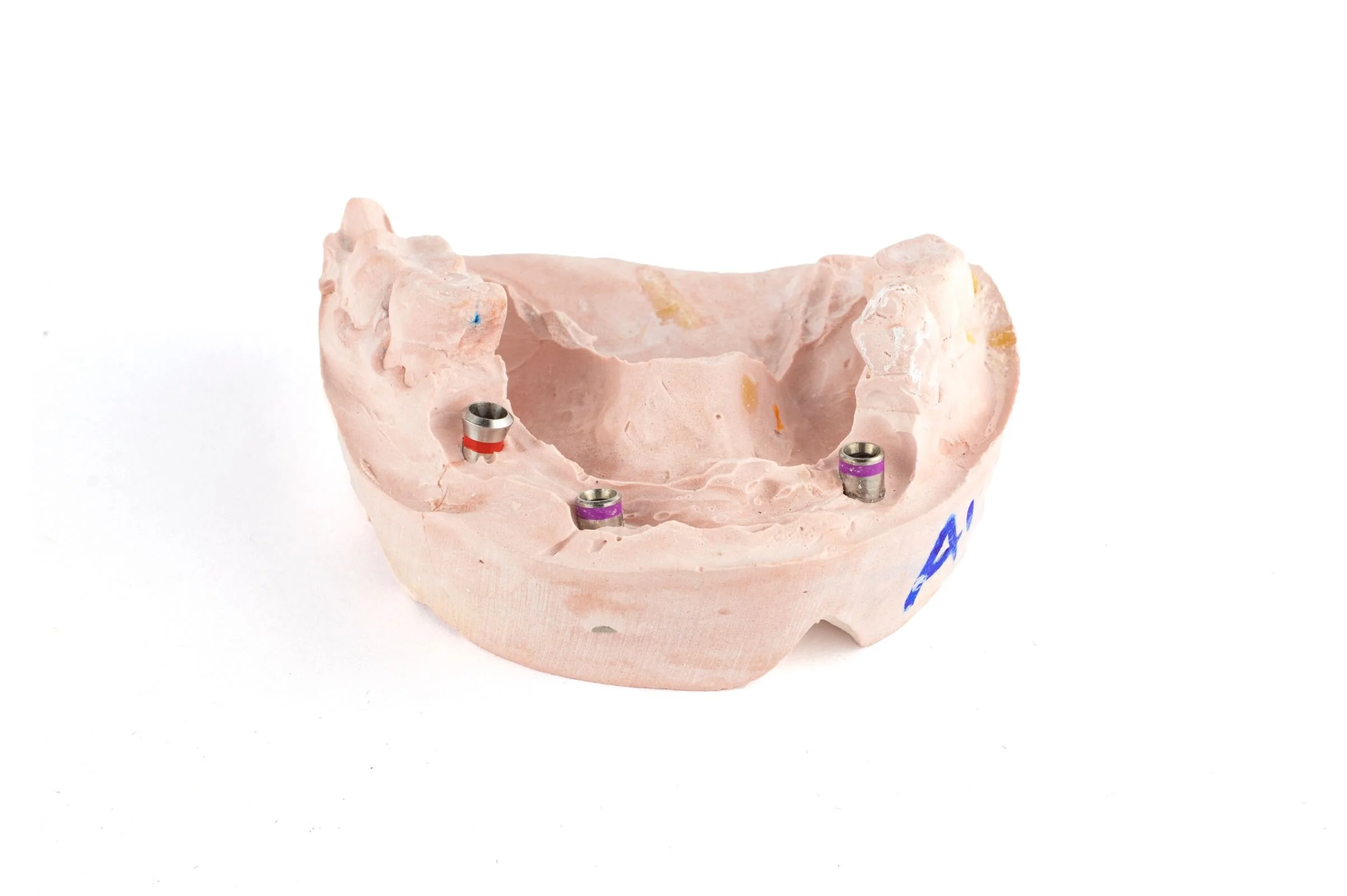 b nexus-micro-abutment-front3.jpg