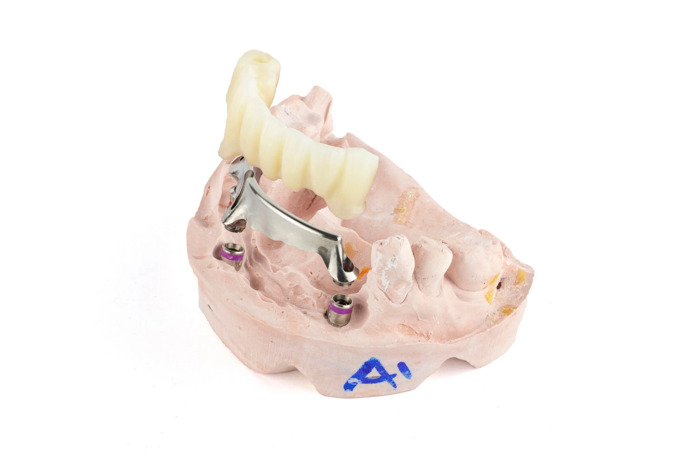 a nexus-micro-all-stacked-front-left.jpg