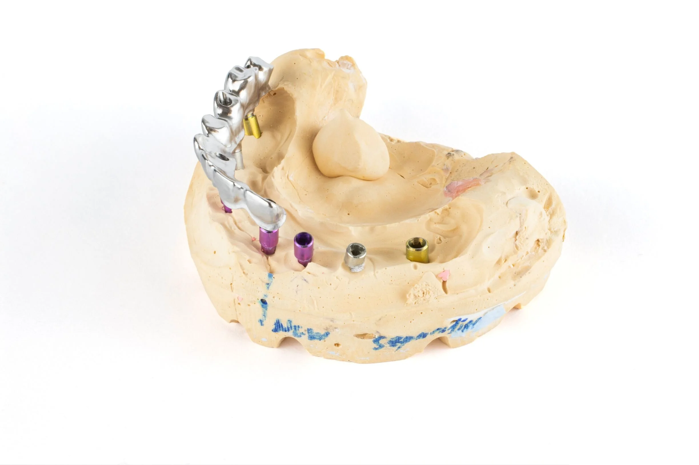 abb 210129-anatomical-bridge-front-left-a.jpg