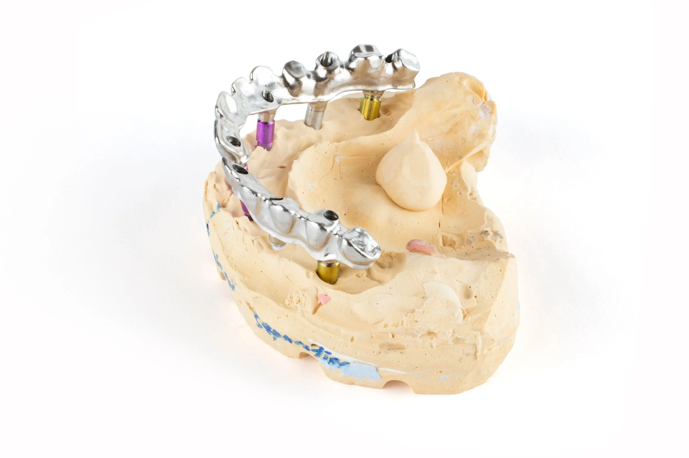 acb 210129-anatomical-bridge-left-b.jpg