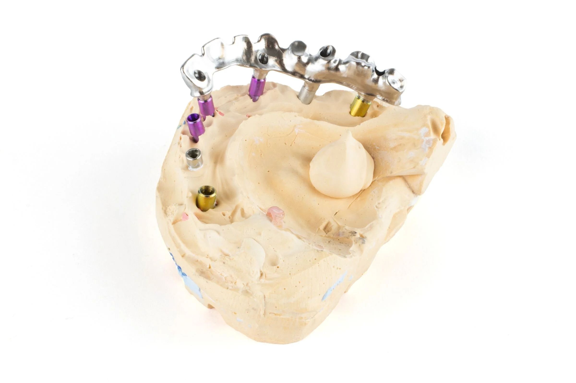 ada 210129-anatomical-bridge-back-left-a.jpg