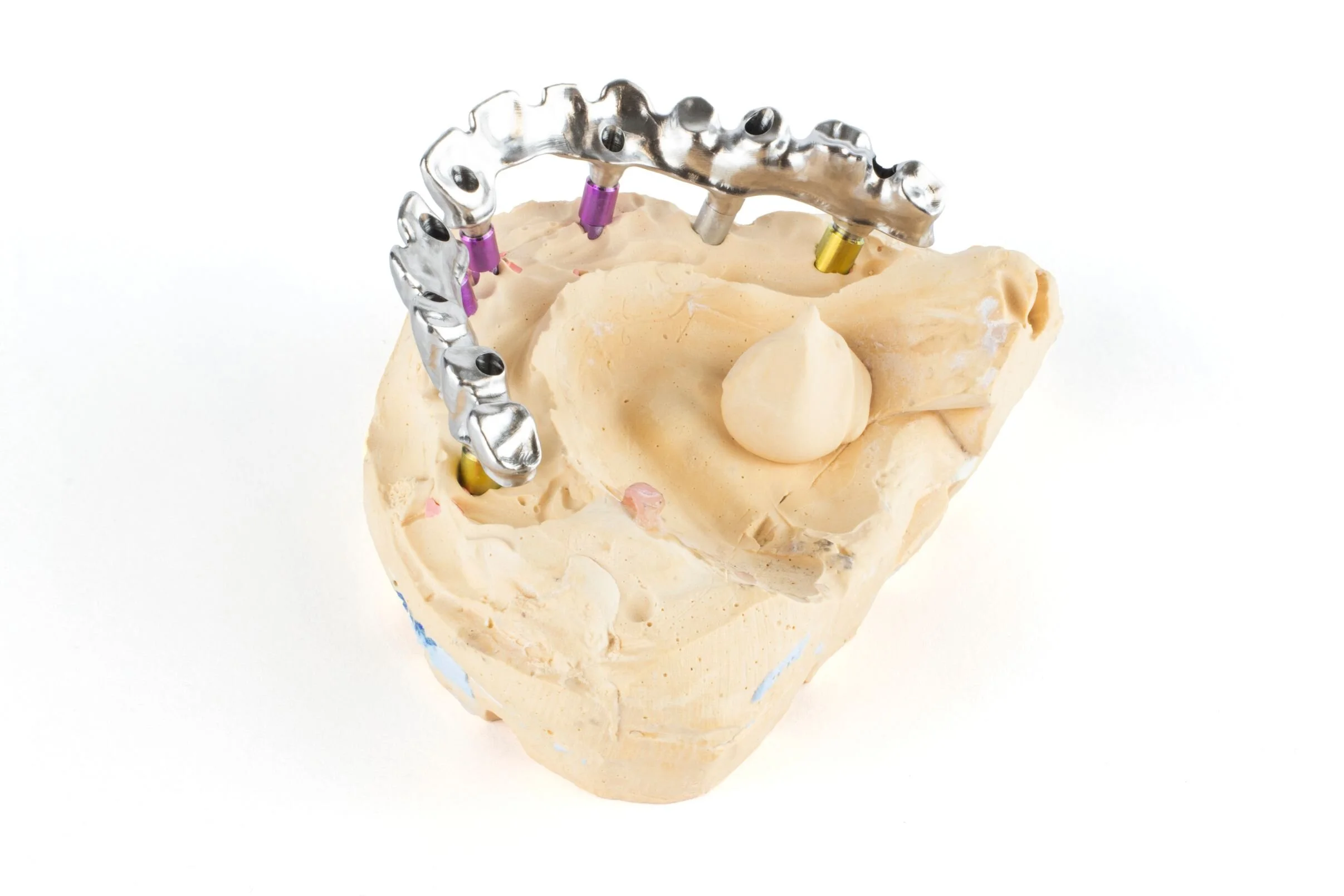 adb 210129-anatomical-bridge-back-left-b.jpg