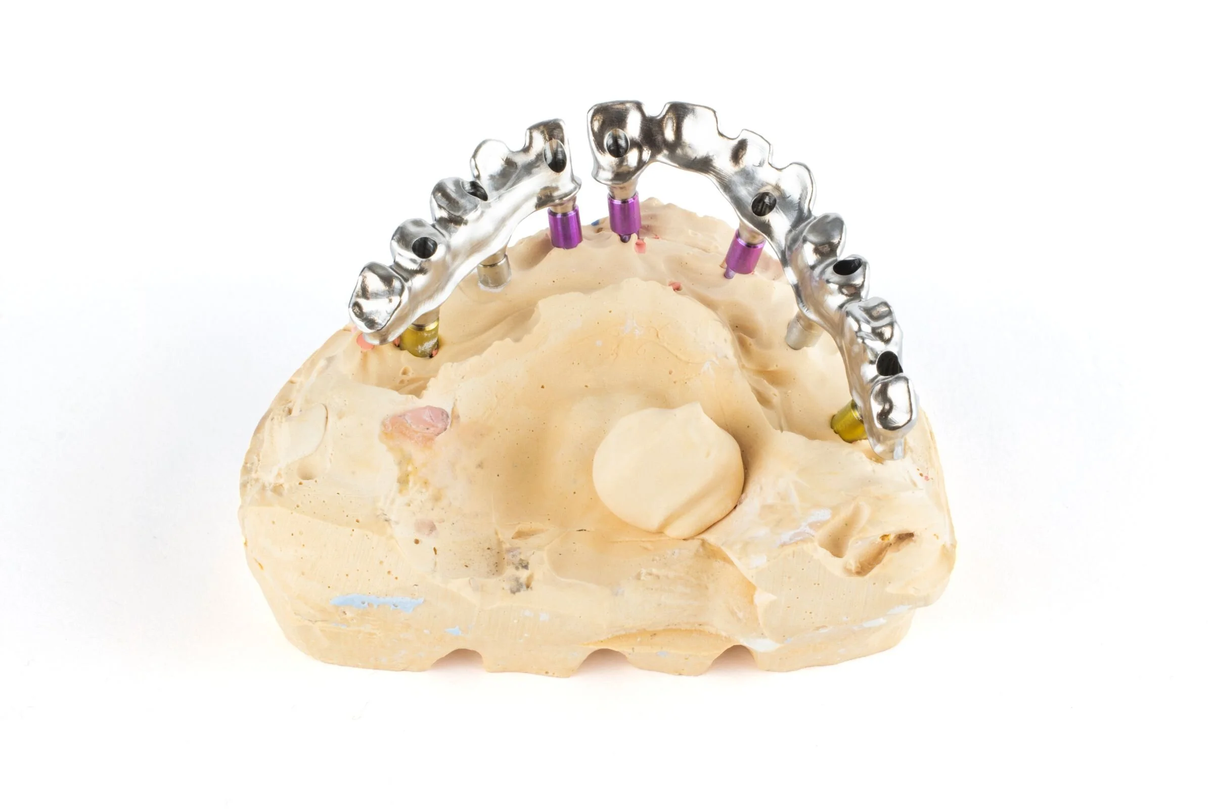 aeb 210129-anatomical-bridge-back-b.jpg