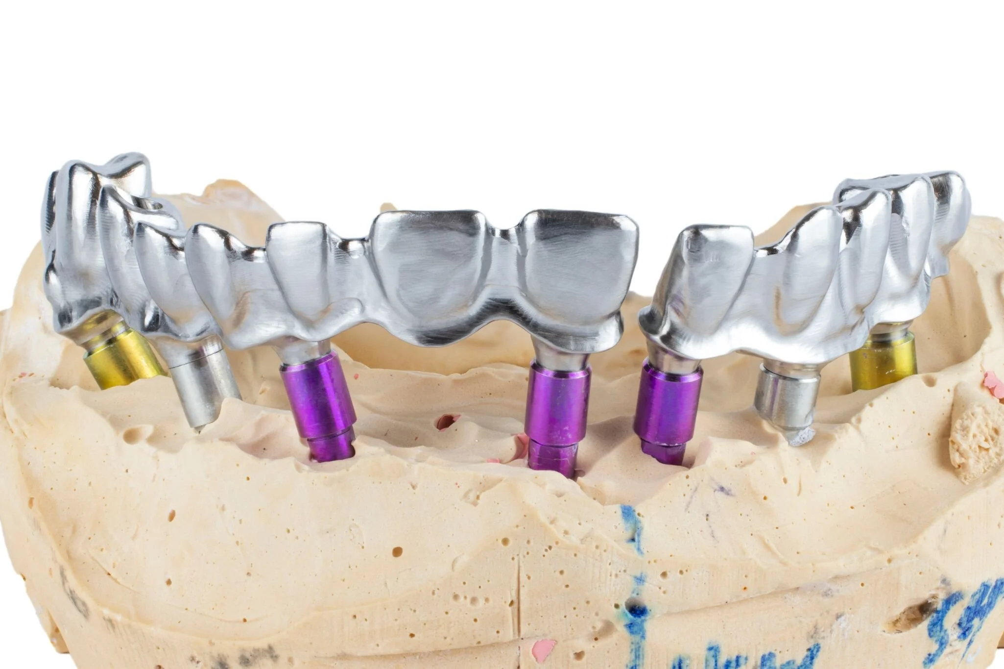 ah anatomical-bridge-closeup-crop.jpg