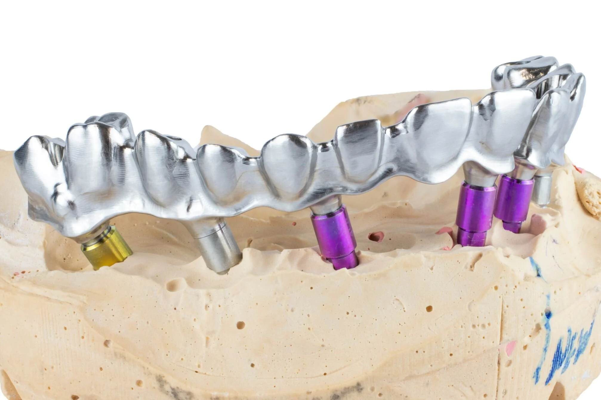 ai anatomical-bridge-closeup-crop-right.jpg