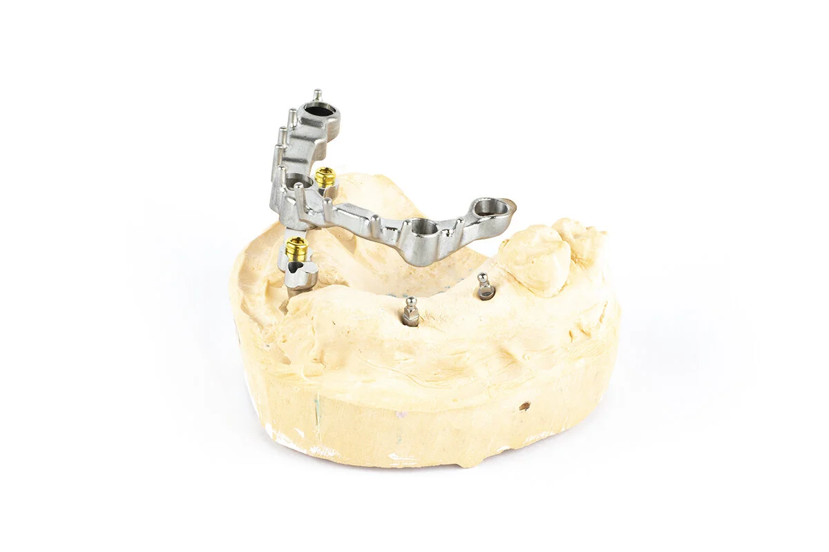 Case of the Month: APRIL