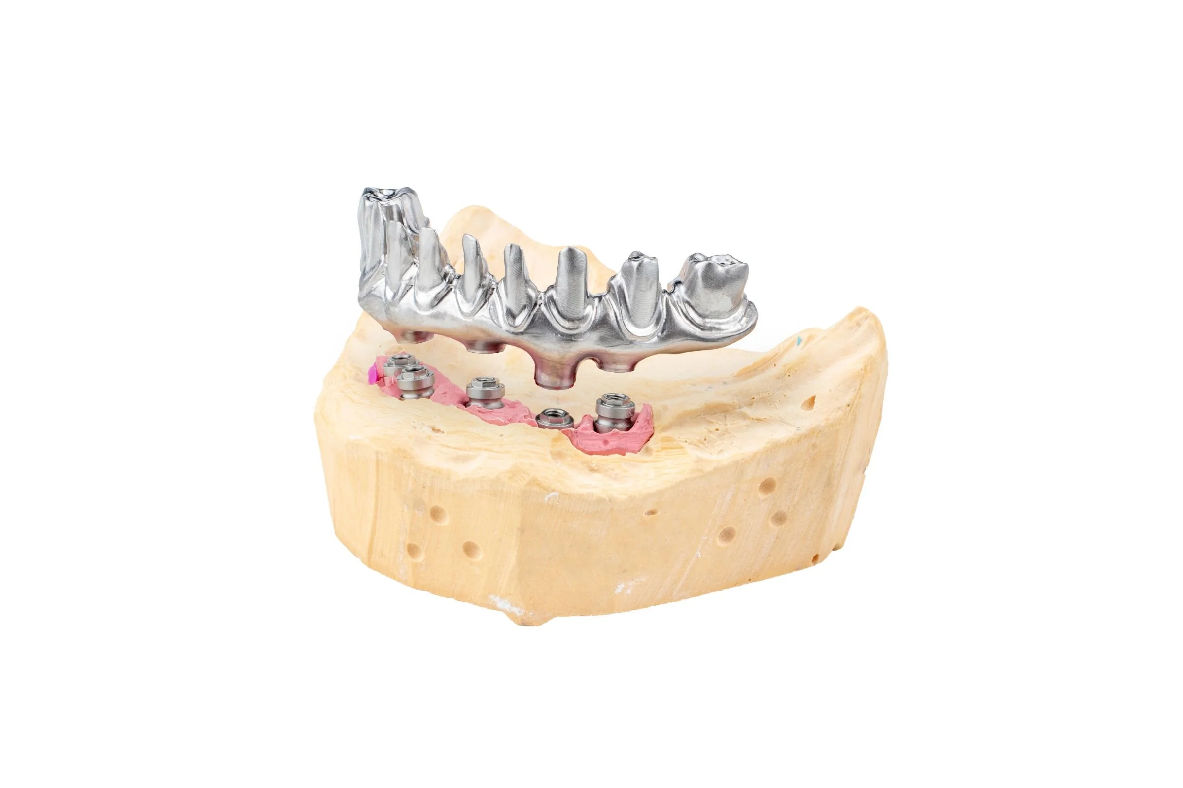 Case of the Month: MAY