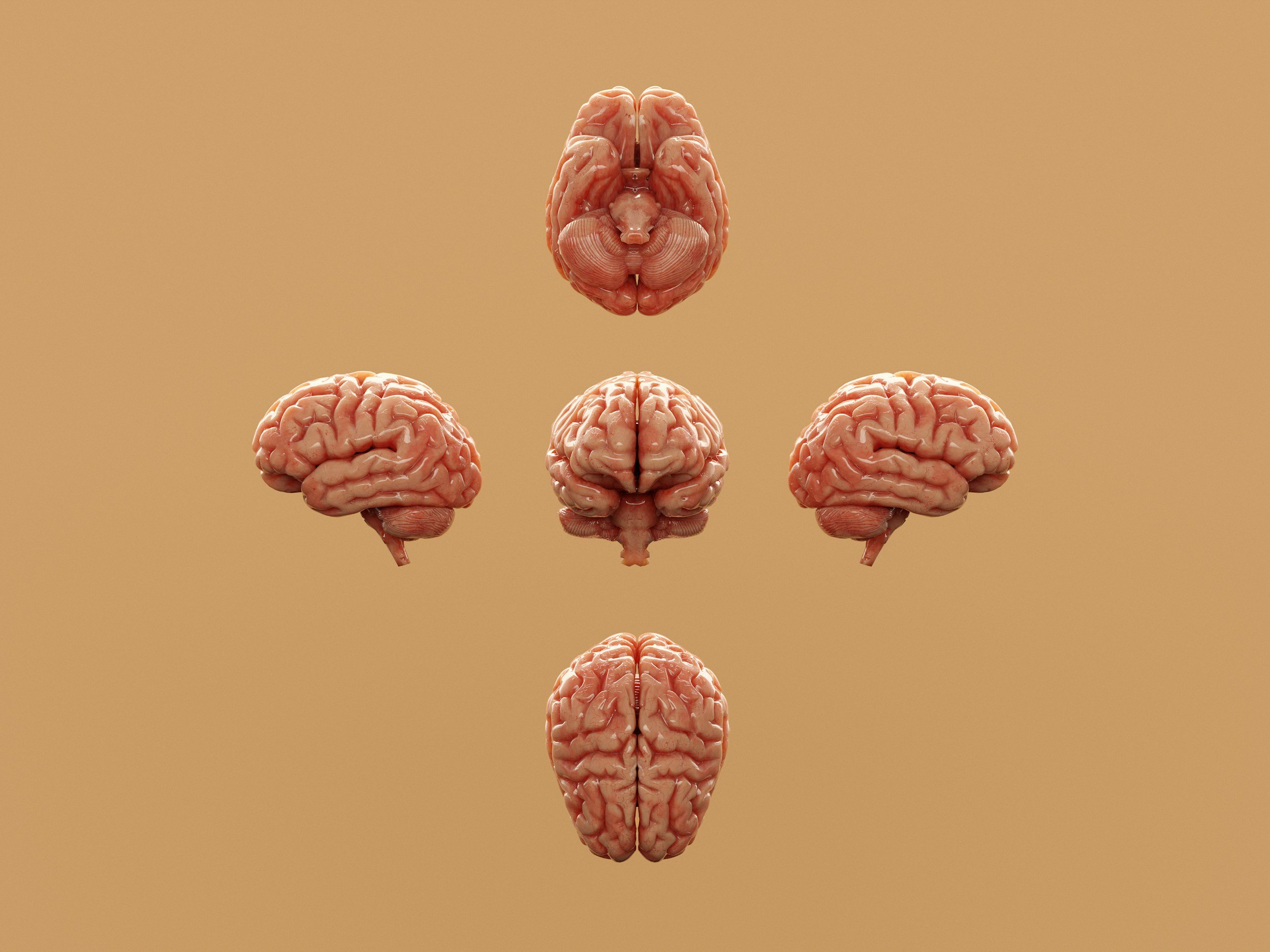 Five images of brains from different sides against a yellow tan background.
