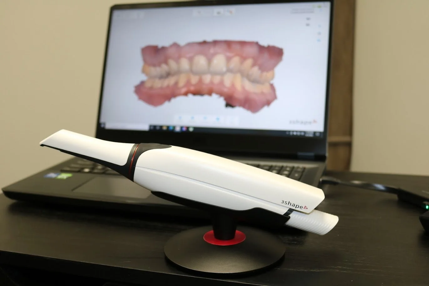 digital dental scanner