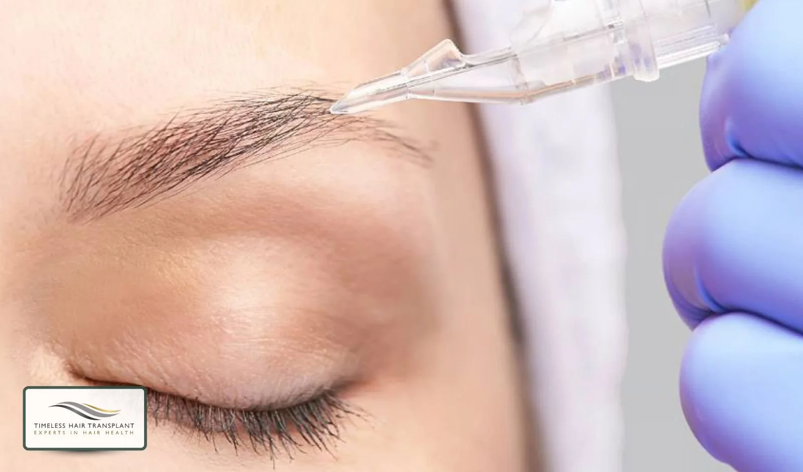 How the Procedure Is Performed