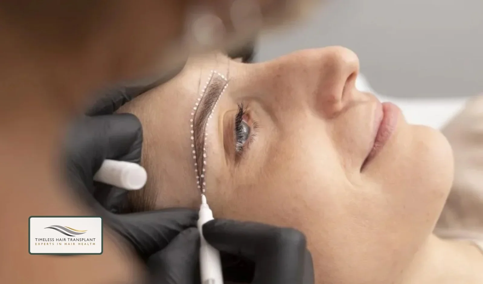 How Many Grafts Are Needed