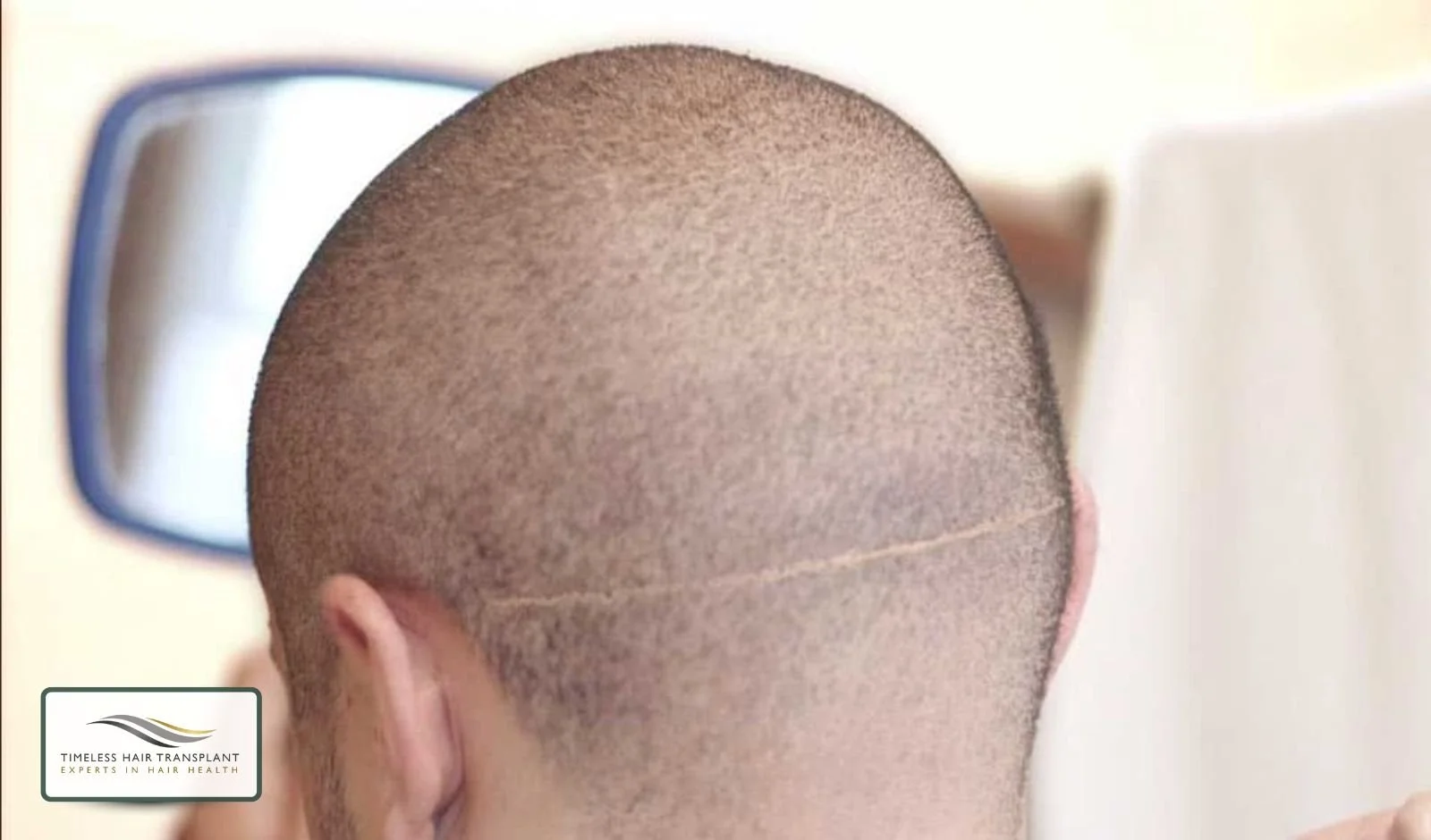 Things to Keep in Mind