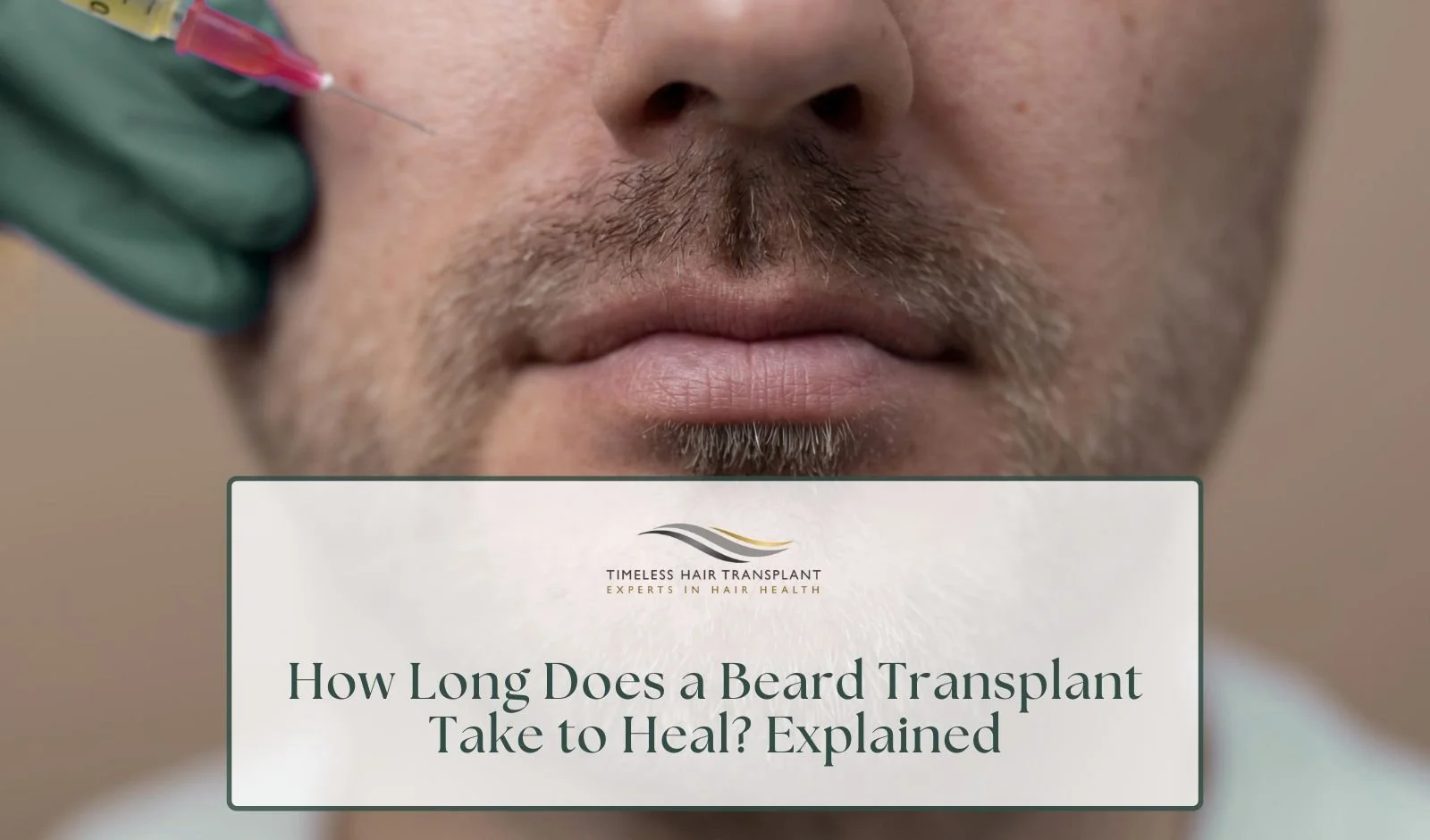 How Long Does a Beard Transplant Take to Heal? Explained&nbsp;