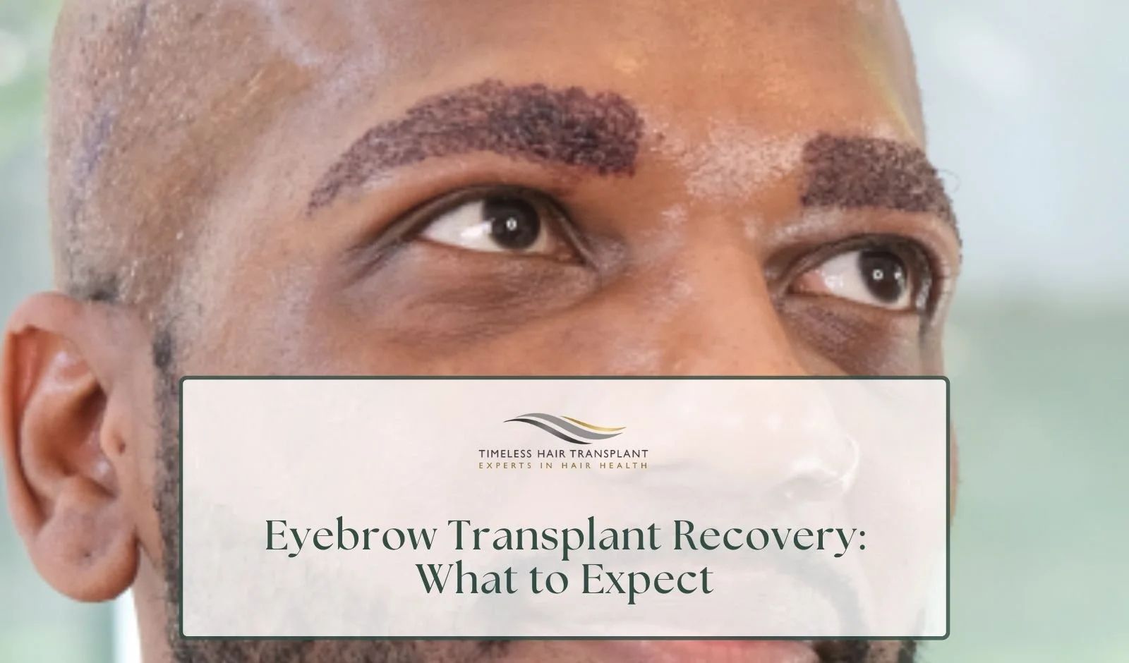 Eyebrow Transplant Recovery: What to Expect