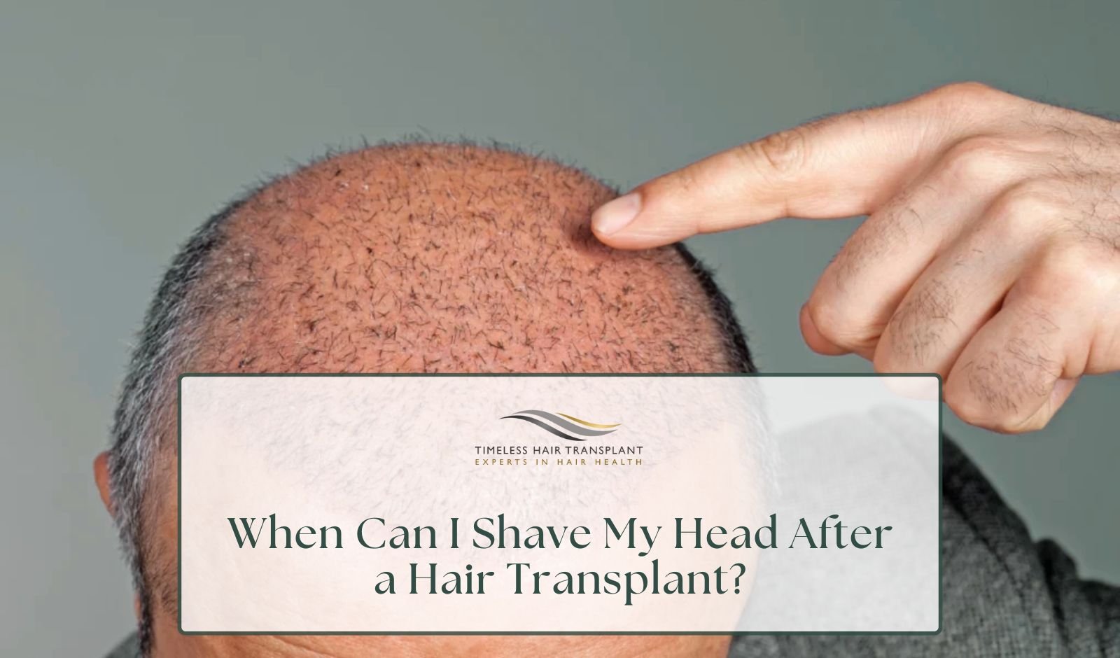 When Can I Shave My Head After a Hair Transplant?